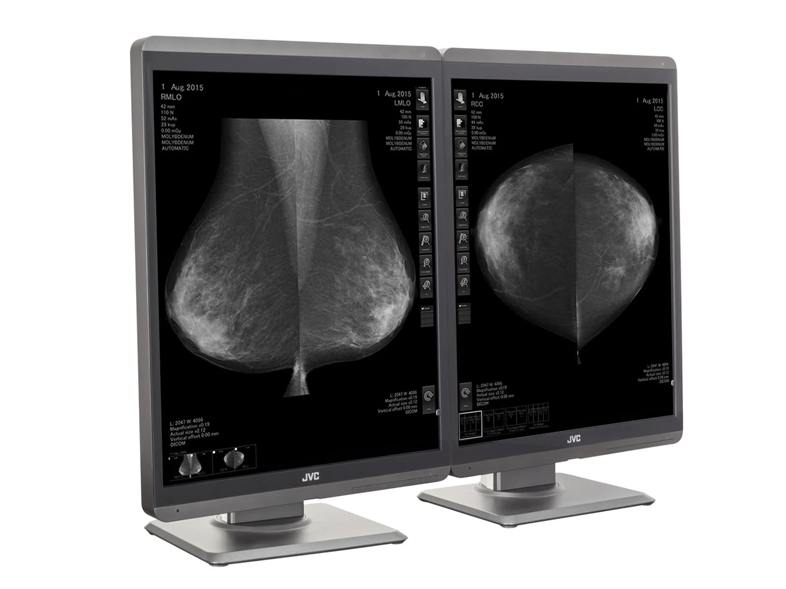 JVC Totoku MS-S500 5MP 21" Mammo 3D-DBT Grayscale Breast Imaging Display (MS-S500) 2 JVC Totoku MS-S500 5MP 21" Mammo 3D-DBT Grayscale Breast Imaging Display (MS-S500)