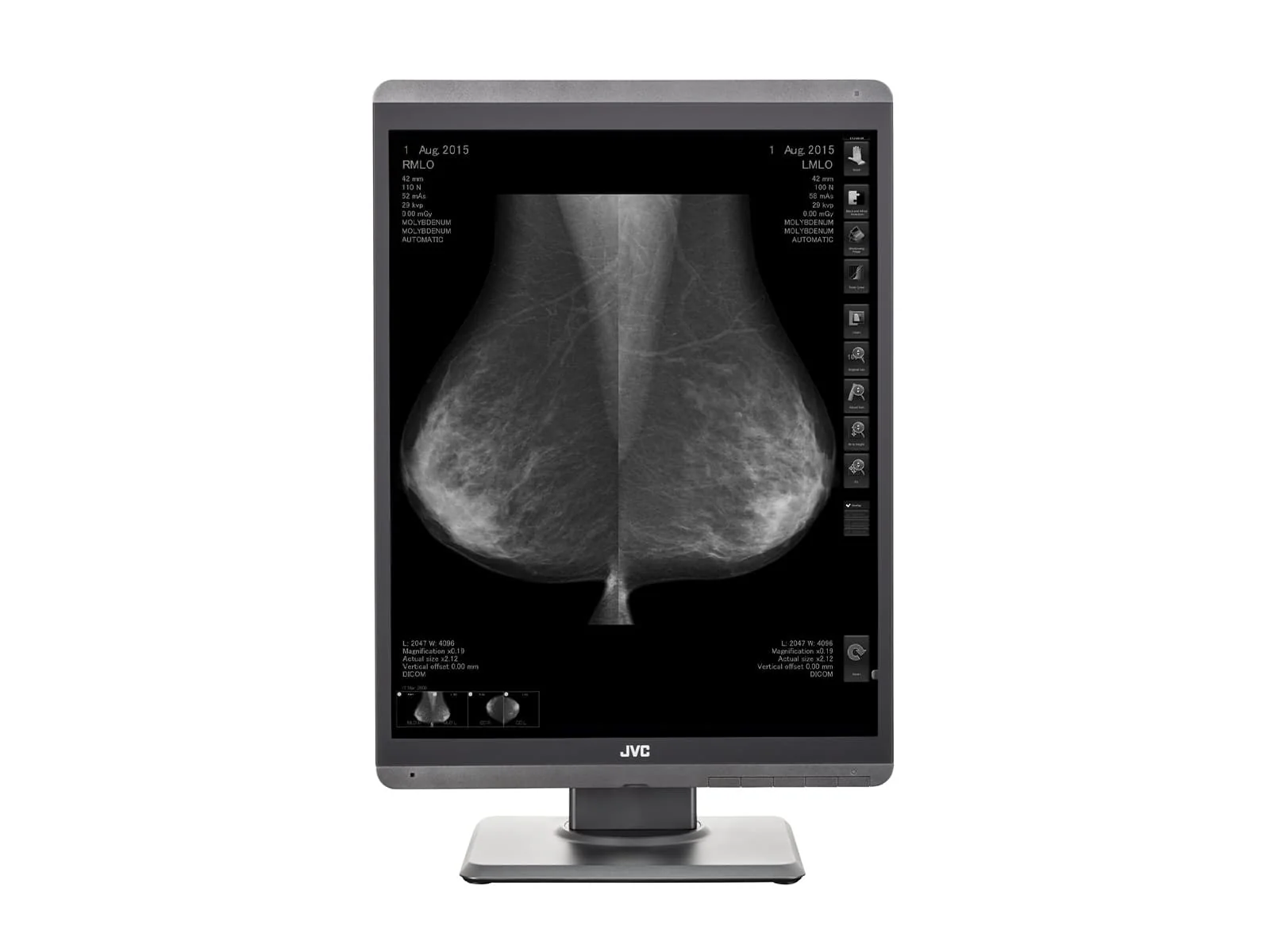 JVC Totoku MS-S500 5MP 21" Mammo 3D-DBT Grayscale Breast Imaging Display (MS-S500) 4 JVC Totoku MS-S500 5MP 21" Mammo 3D-DBT Grayscale Breast Imaging Display (MS-S500)