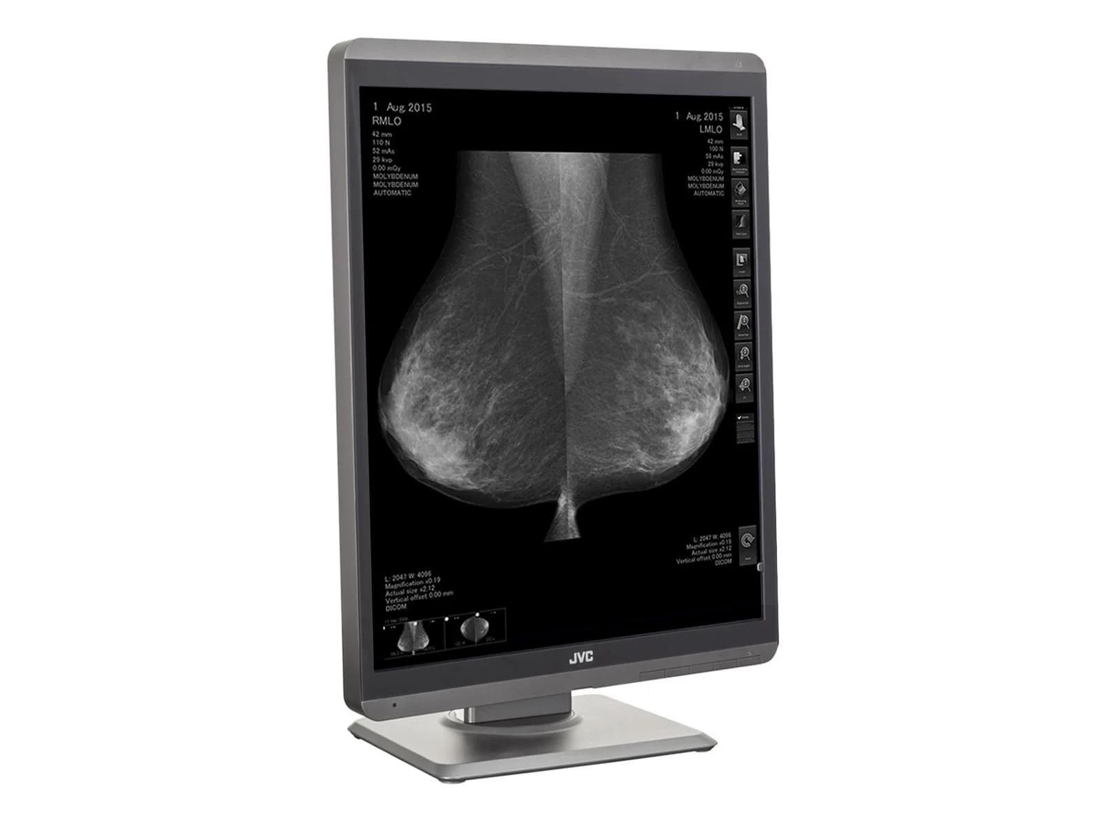 JVC Totoku MS-S500 5MP 21" Mammo 3D-DBT Grayscale Breast Imaging Display (MS-S500) 5 JVC Totoku MS-S500 5MP 21" Mammo 3D-DBT Grayscale Breast Imaging Display (MS-S500)