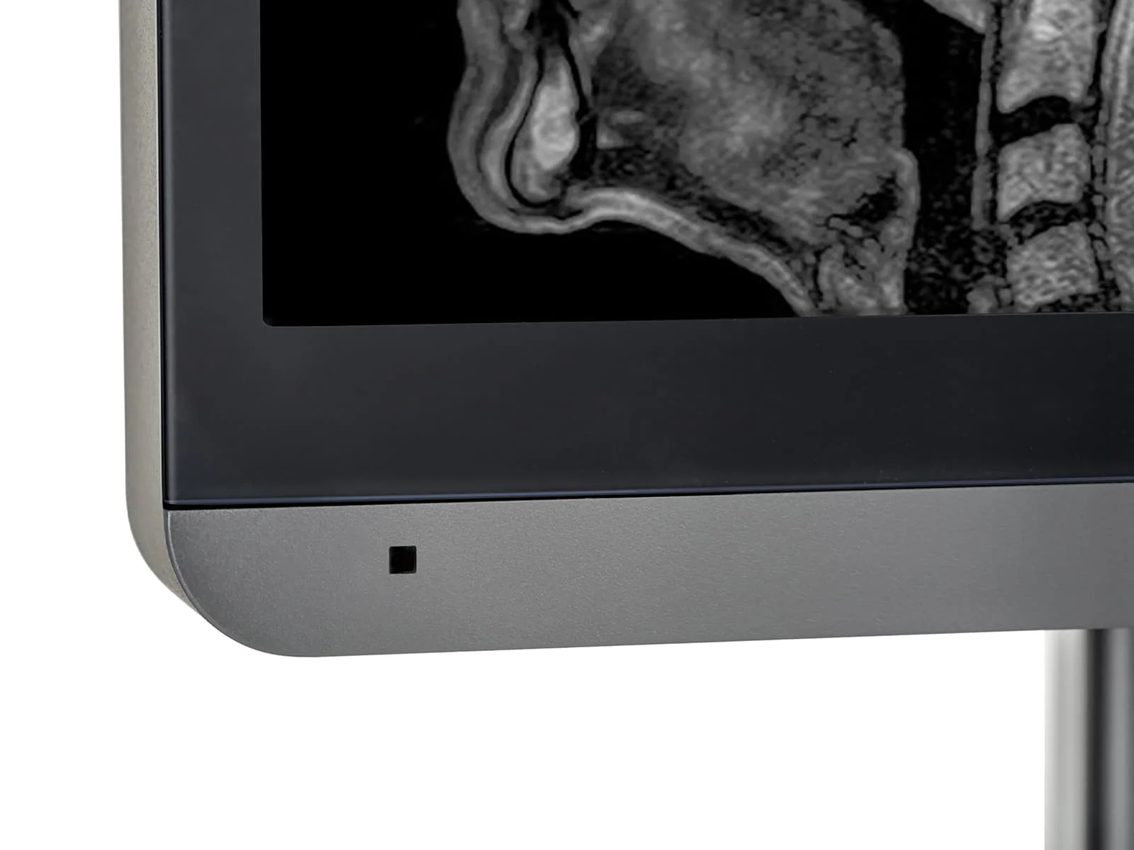 JVC Totoku MS-S500 5MP 21" Mammo 3D-DBT Grayscale Breast Imaging Display (MS-S500) 7 JVC Totoku MS-S500 5MP 21" Mammo 3D-DBT Grayscale Breast Imaging Display (MS-S500)
