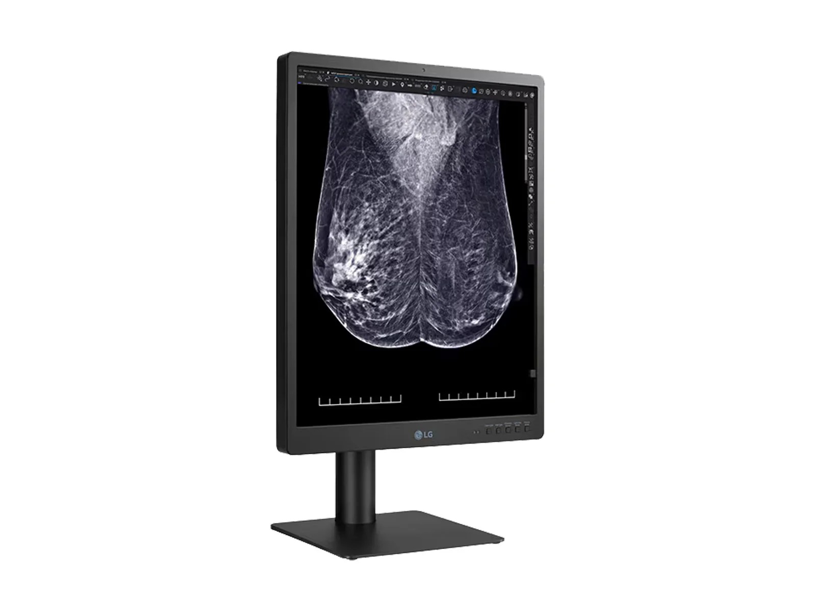 LG 5MP 21" 21HQ613D-B Color Mammography 3D-Tomosynthesis Breast Imaging Display Monitor 10 LG 5MP 21" 21HQ613D-B Color Mammography 3D-Tomosynthesis Breast Imaging Display Monitor