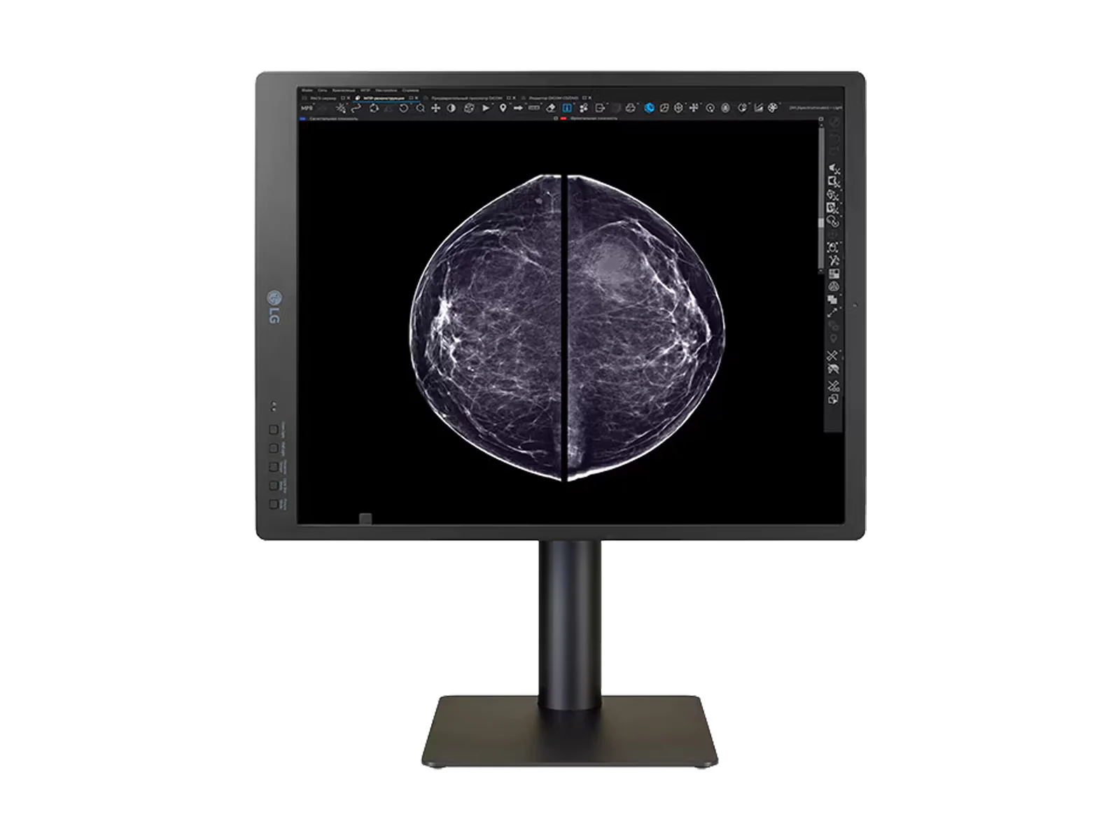 LG 5MP 21" 21HQ613D-B Color Mammography 3D-Tomosynthesis Breast Imaging Display Monitor 12 LG 5MP 21" 21HQ613D-B Color Mammography 3D-Tomosynthesis Breast Imaging Display Monitor