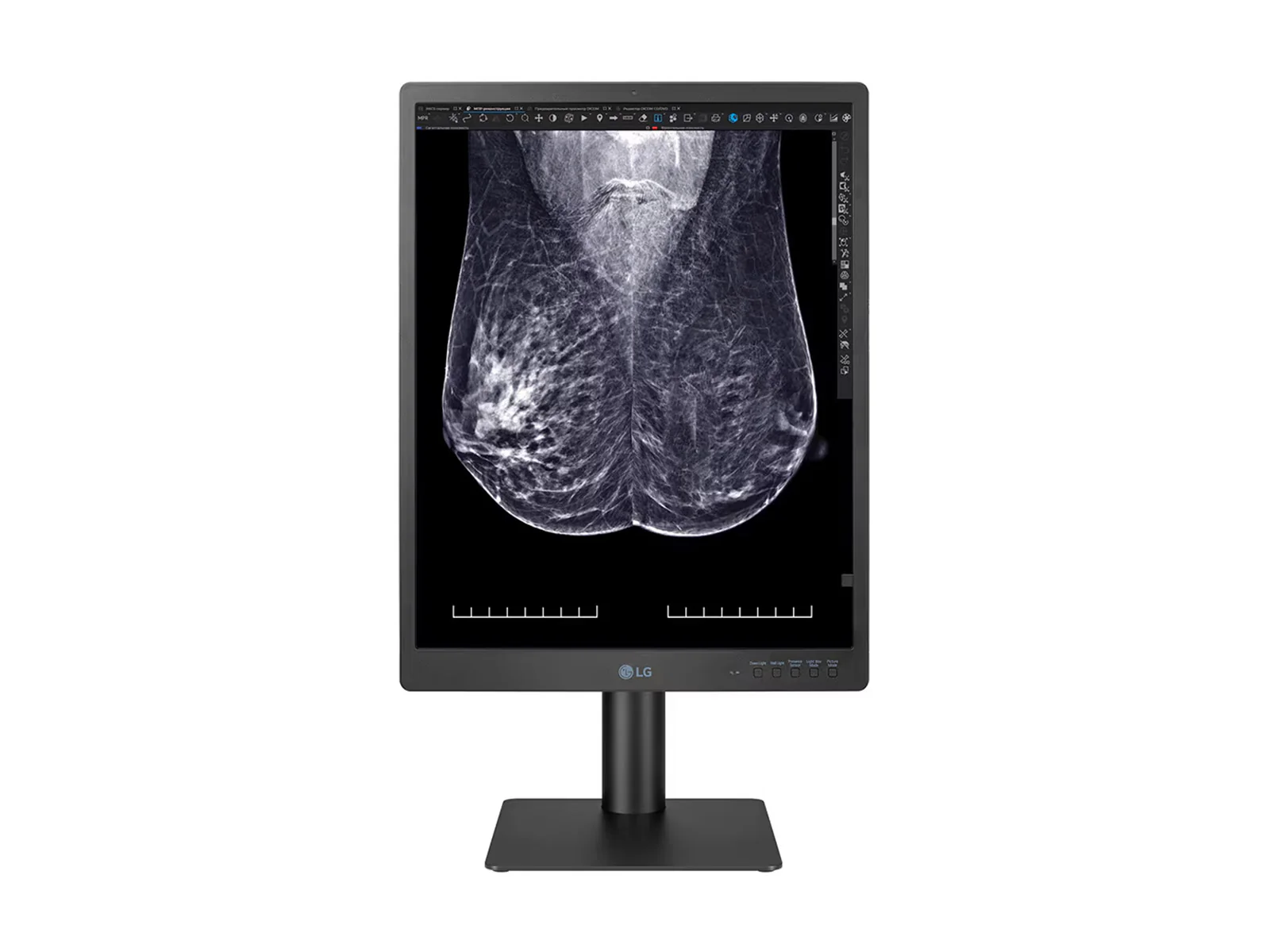 LG 5MP 21" 21HQ613D-B Color Mammography 3D-Tomosynthesis Breast Imaging Display Monitor 2 LG 5MP 21" 21HQ613D-B Color Mammography 3D-Tomosynthesis Breast Imaging Display Monitor