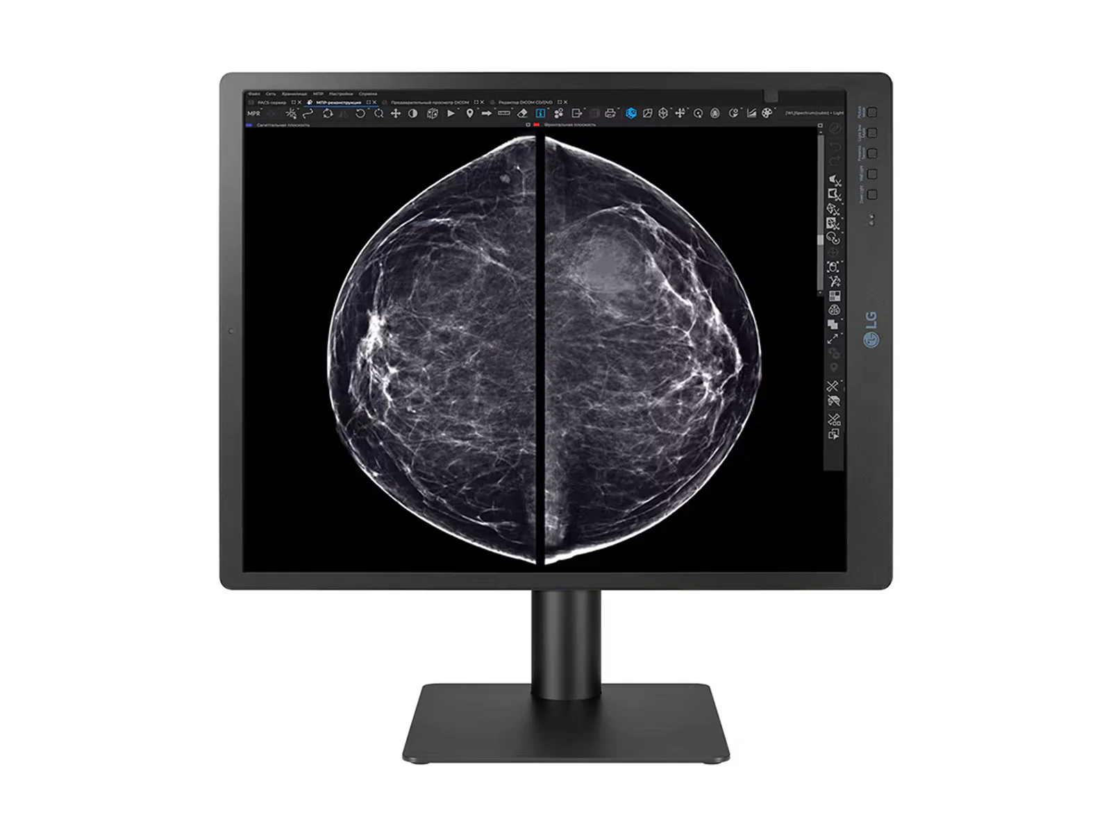 LG 5MP 21" 21HQ613D-B Color Mammography 3D-Tomosynthesis Breast Imaging Display Monitor 3 LG 5MP 21" 21HQ613D-B Color Mammography 3D-Tomosynthesis Breast Imaging Display Monitor