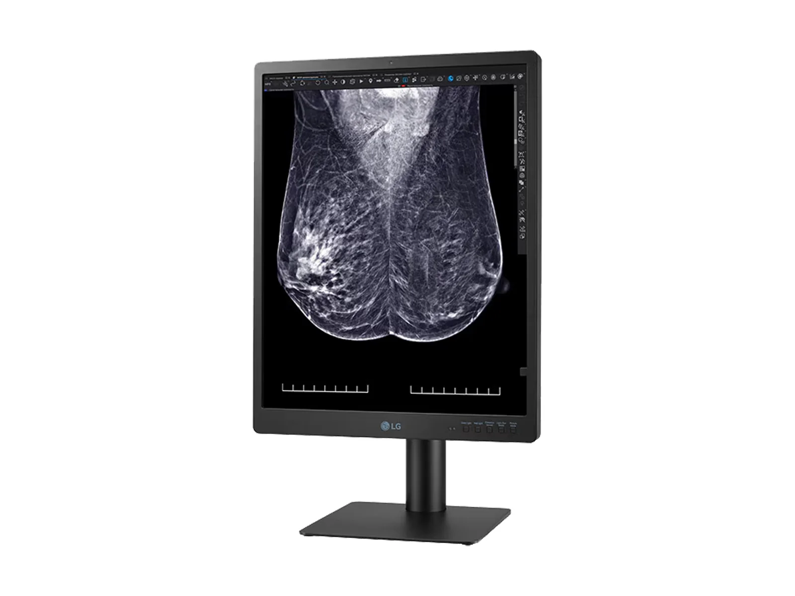 LG 5MP 21" 21HQ613D-B Color Mammography 3D-Tomosynthesis Breast Imaging Display Monitor 8 LG 5MP 21" 21HQ613D-B Color Mammography 3D-Tomosynthesis Breast Imaging Display Monitor