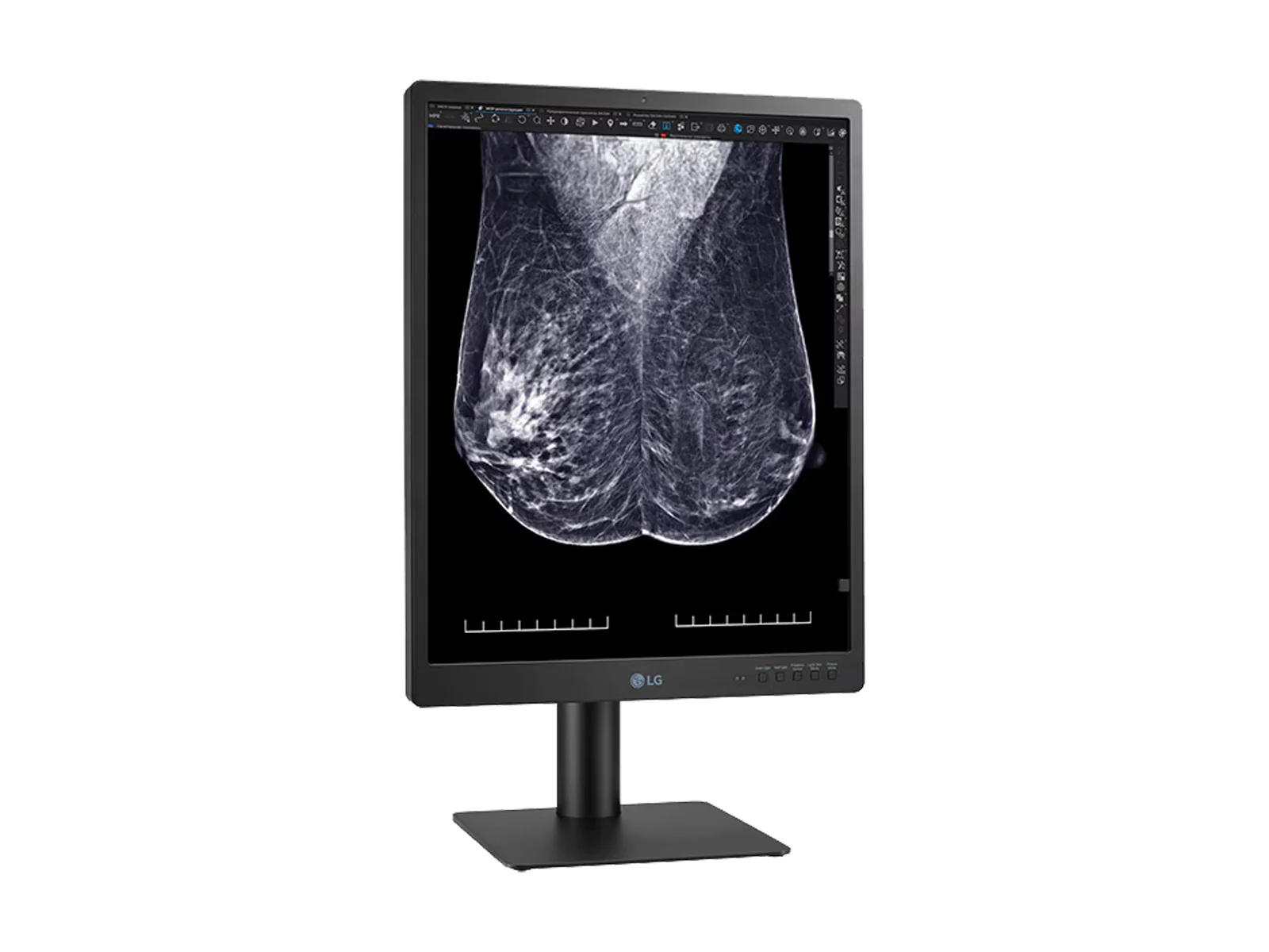LG 5MP 21" 21HQ613D-B Color Mammography 3D-Tomosynthesis Breast Imaging Display Monitor 9 LG 5MP 21" 21HQ613D-B Color Mammography 3D-Tomosynthesis Breast Imaging Display Monitor