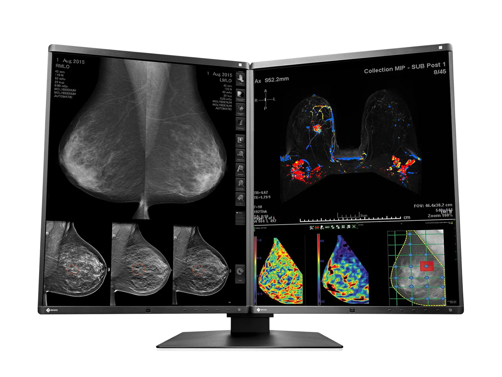 Eizo RadiForce RX570 5MP 21" Color Mammo 3D-DBT Breast Imaging Display (RX570-BK) 2 Eizo RadiForce RX570 5MP 21" Color Mammo 3D-DBT Breast Imaging Display (RX570-BK)