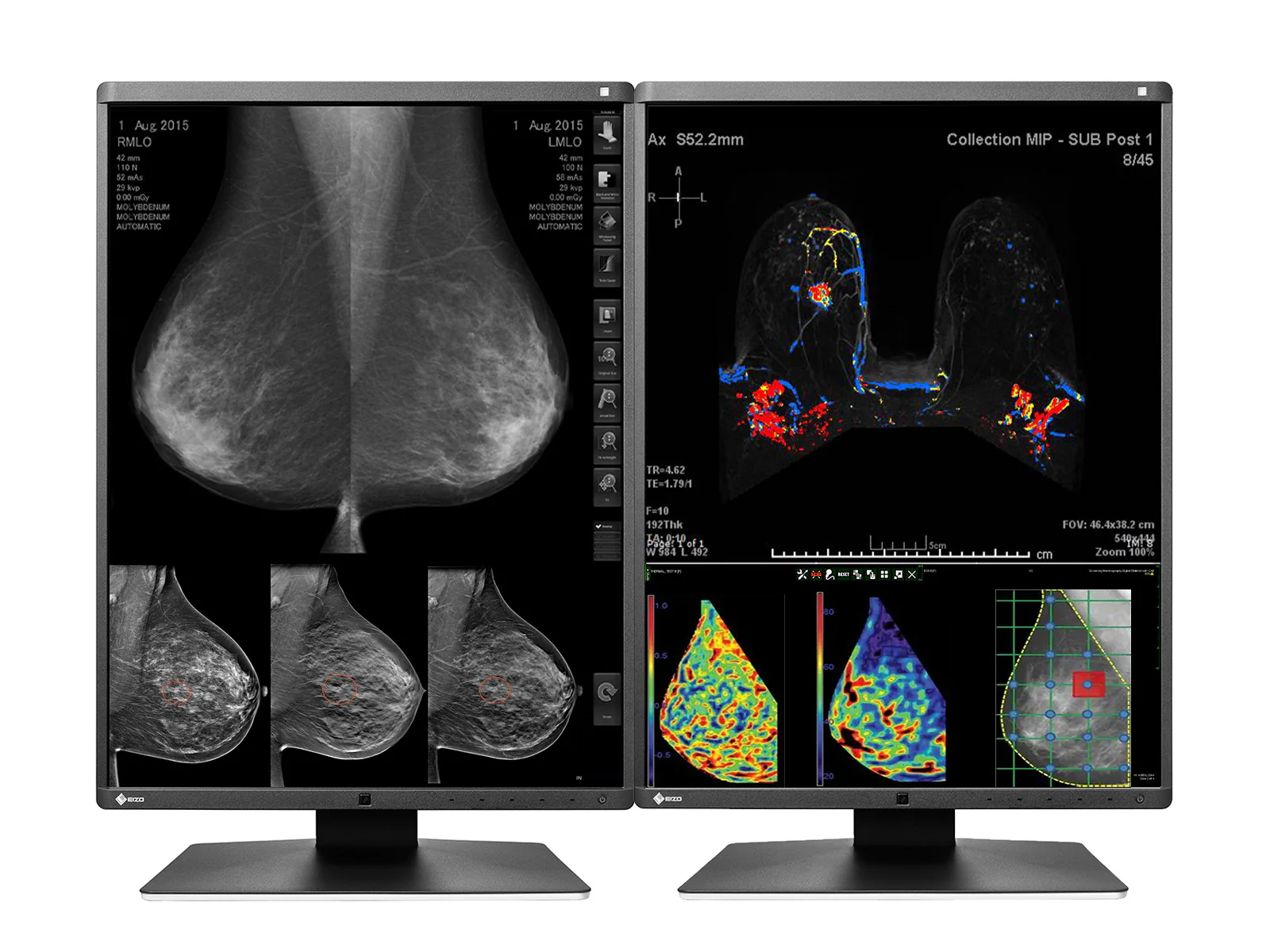Eizo RadiForce RX570 5MP 21" Color Mammo 3D-DBT Breast Imaging Display (RX570-BK) 3 Eizo RadiForce RX570 5MP 21" Color Mammo 3D-DBT Breast Imaging Display (RX570-BK)