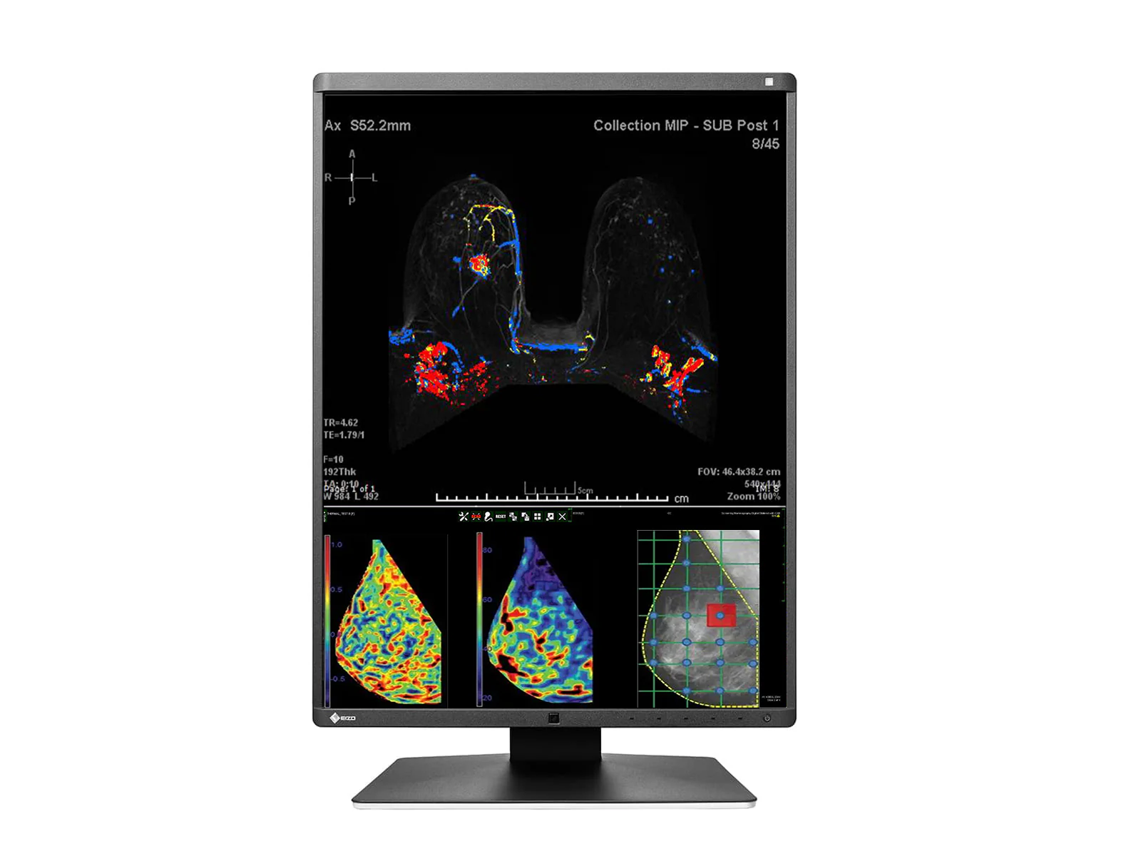 Eizo RadiForce RX570 5MP 21" Color Mammo 3D-DBT Breast Imaging Display (RX570-BK) 4 Eizo RadiForce RX570 5MP 21" Color Mammo 3D-DBT Breast Imaging Display (RX570-BK)
