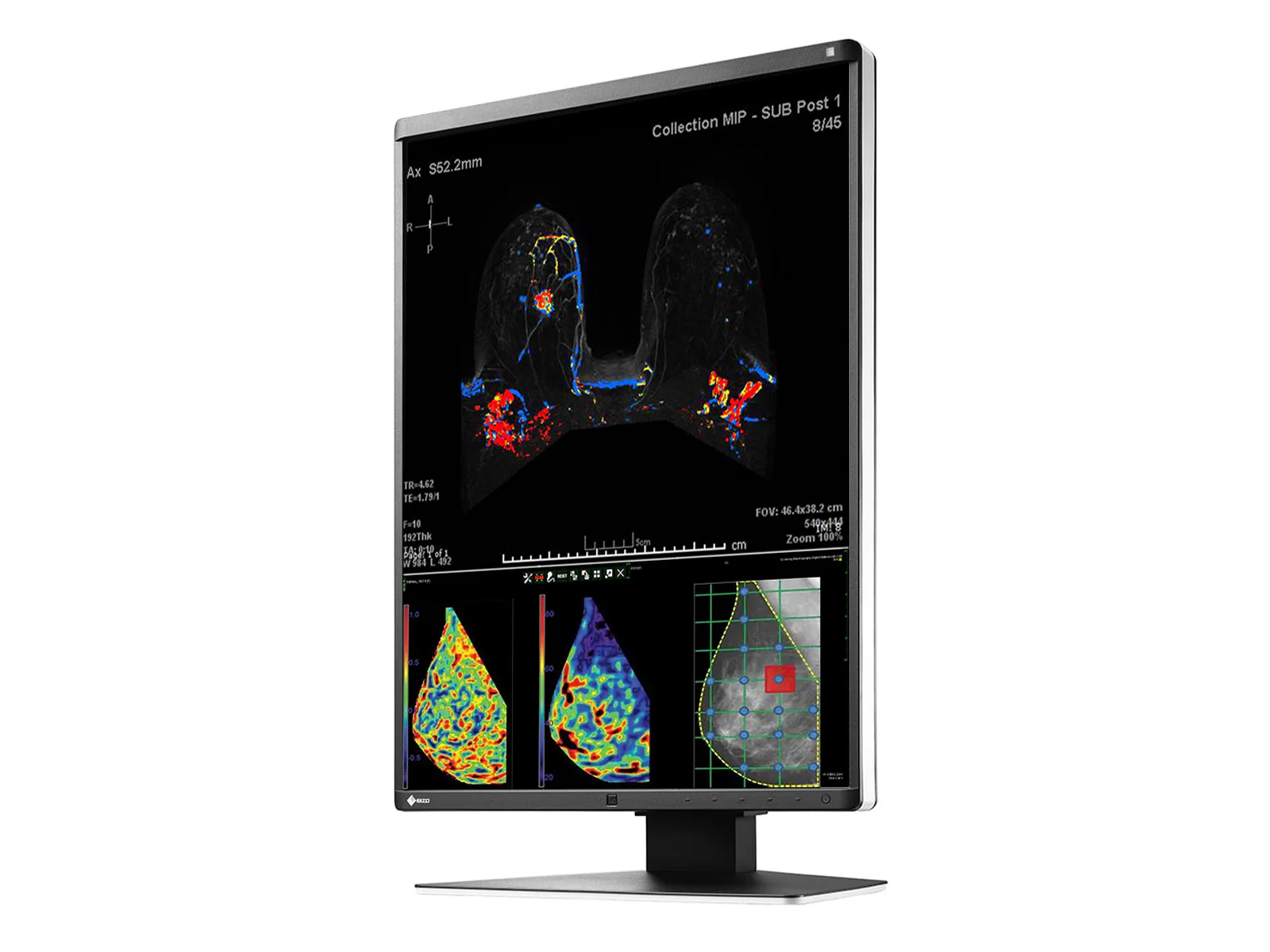 Eizo RadiForce RX570 5MP 21" Color Mammo 3D-DBT Breast Imaging Display (RX570-BK) 5 Eizo RadiForce RX570 5MP 21" Color Mammo 3D-DBT Breast Imaging Display (RX570-BK)