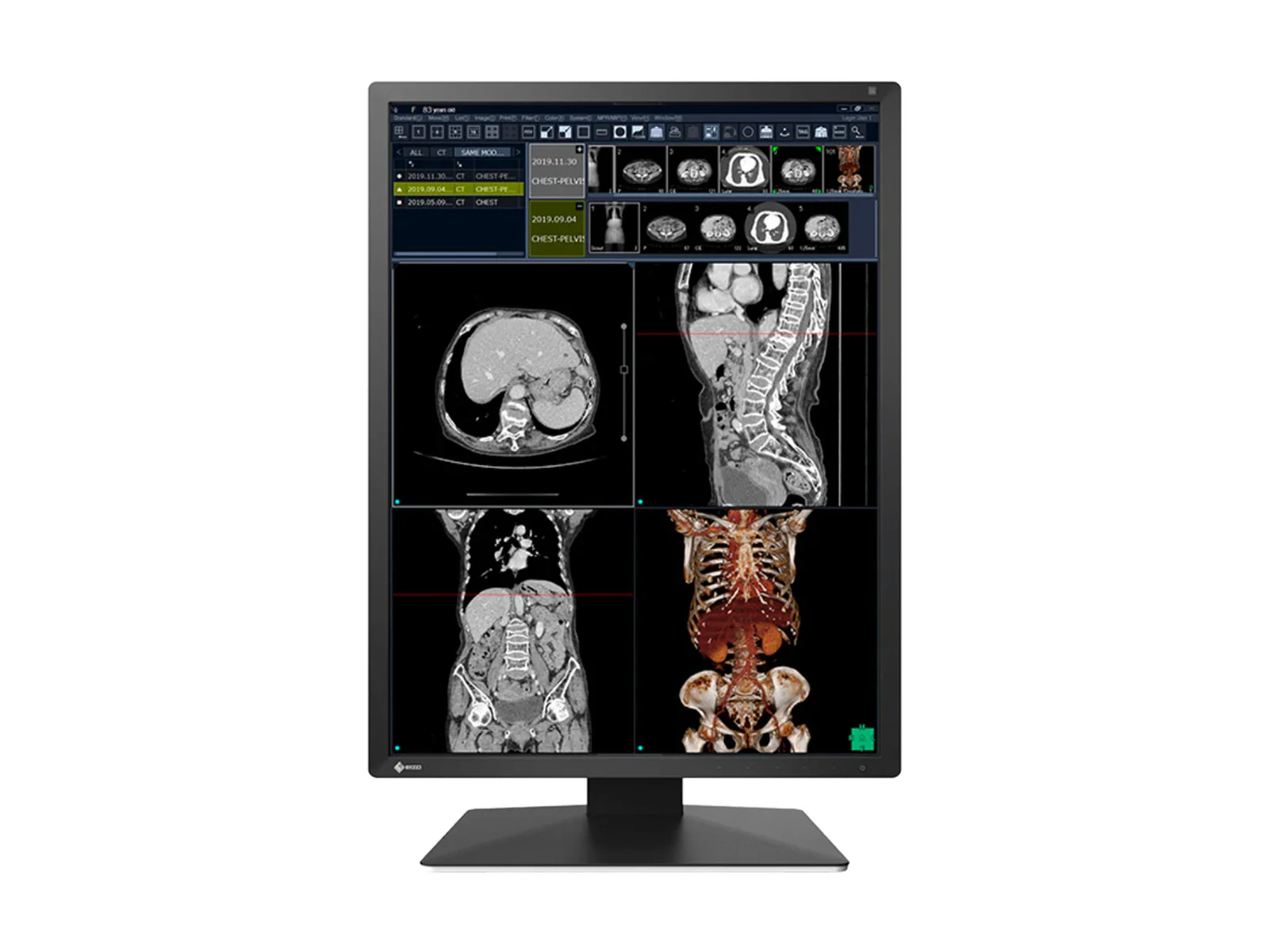 Eizo RadiForce RX270 2MP 21" Color Medical Diagnostic Radiology Display Monitor (RX270-BK) 2 Eizo RadiForce RX270 2MP 21" Color Medical Diagnostic Radiology Display Monitor (RX270-BK)