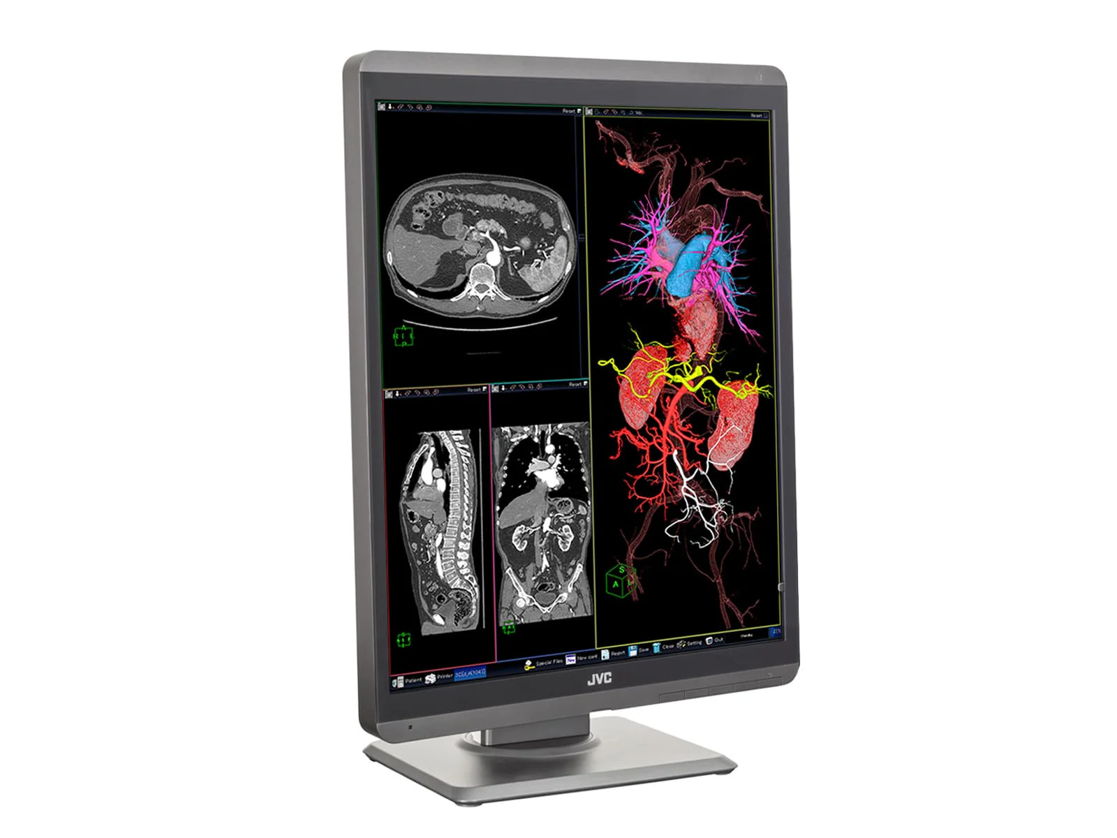JVC Totoku CL-S200 2MP 21" Color PACS Display Monitor (CL-S200) 5 JVC Totoku CL-S200 2MP 21" Color PACS Display Monitor (CL-S200)