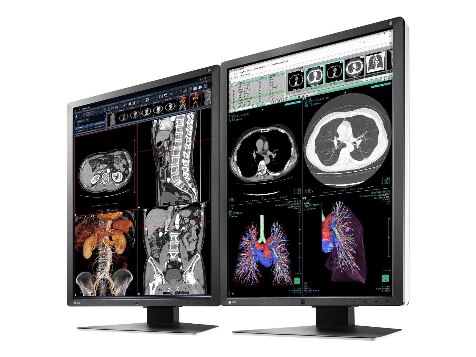 Eizo RadiForce RX250 2MP 21" Color Medical Diagnostic Radiology Display Monitor (RX250-BK) 2 Eizo RadiForce RX250 2MP 21" Color Medical Diagnostic Radiology Display Monitor (RX250-BK)