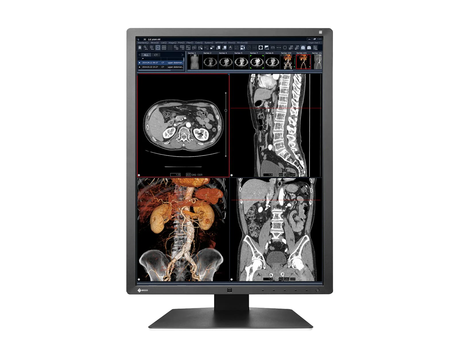 Eizo RadiForce RX250 2MP 21" Color Medical Diagnostic Radiology Display Monitor (RX250-BK) 4 Eizo RadiForce RX250 2MP 21" Color Medical Diagnostic Radiology Display Monitor (RX250-BK)