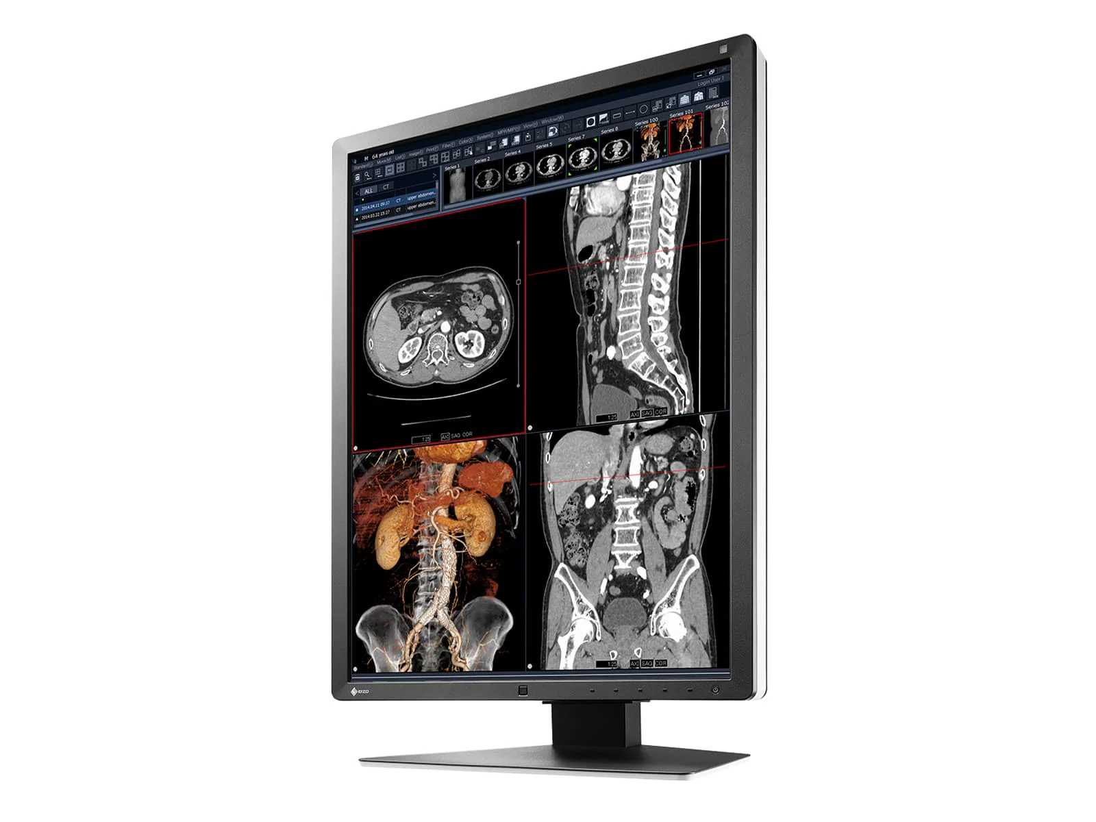 Eizo RadiForce RX250 2MP 21" Color Medical Diagnostic Radiology Display Monitor (RX250-BK) 5 Eizo RadiForce RX250 2MP 21" Color Medical Diagnostic Radiology Display Monitor (RX250-BK)
