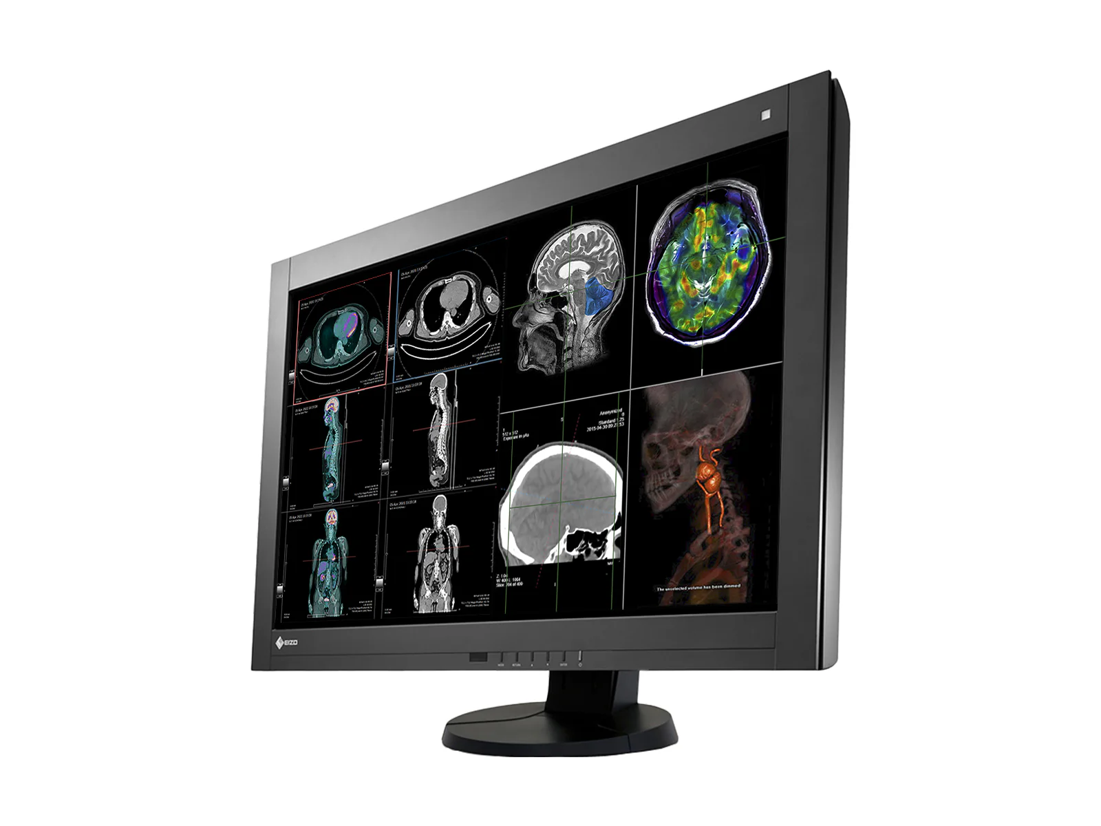 Eizo RadiForce RX440 4MP 30" Color General Radiology PACS Display (RX440-BK) 2 Eizo RadiForce RX440 4MP 30" Color General Radiology PACS Display (RX440-BK)