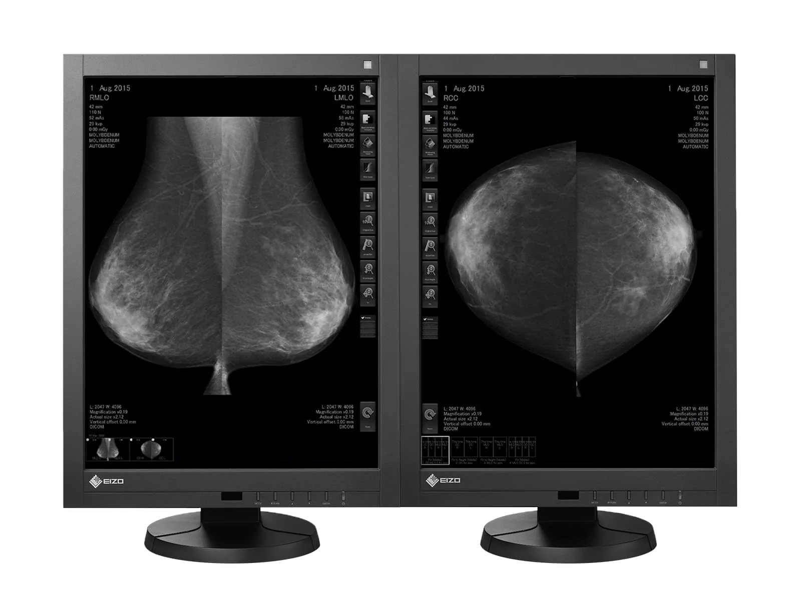 Eizo RadiForce GX540 5MP 21" Grayscale Digital Mammography 3D-DBT Display (GX540-CL)