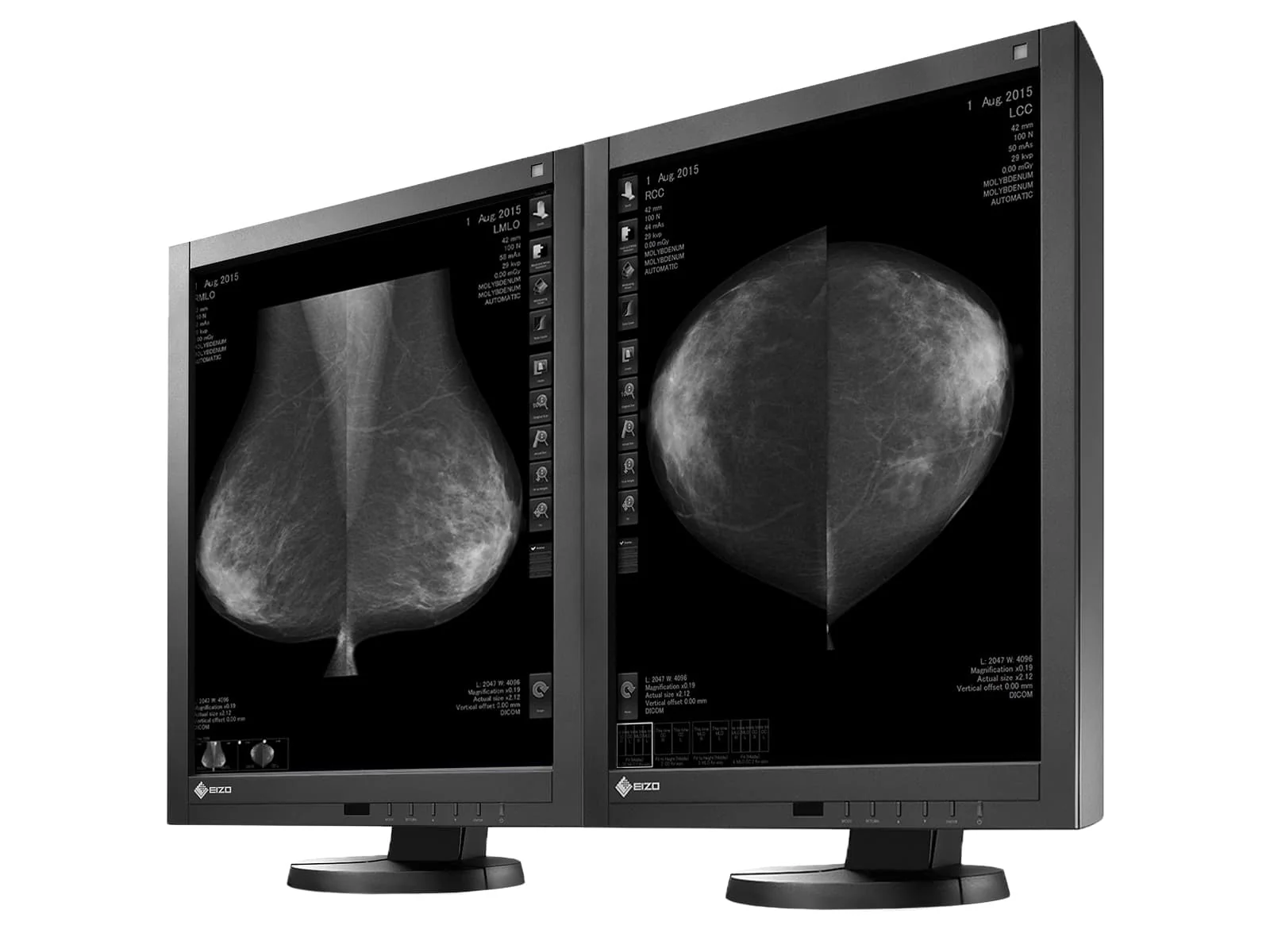 Eizo RadiForce GX540 5MP 21" Grayscale Digital Mammography 3D-DBT Display (GX540-CL) 2 Eizo RadiForce GX540 5MP 21" Grayscale Digital Mammography 3D-DBT Display (GX540-CL)