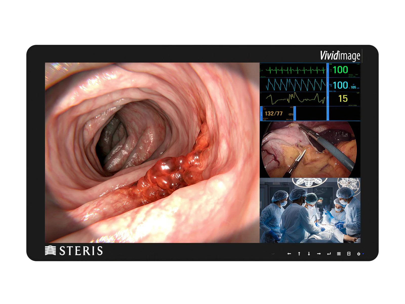 Steris Vividimage D RLM27HD2 27" HD Surgical Display Monitor (RLM27HD2)