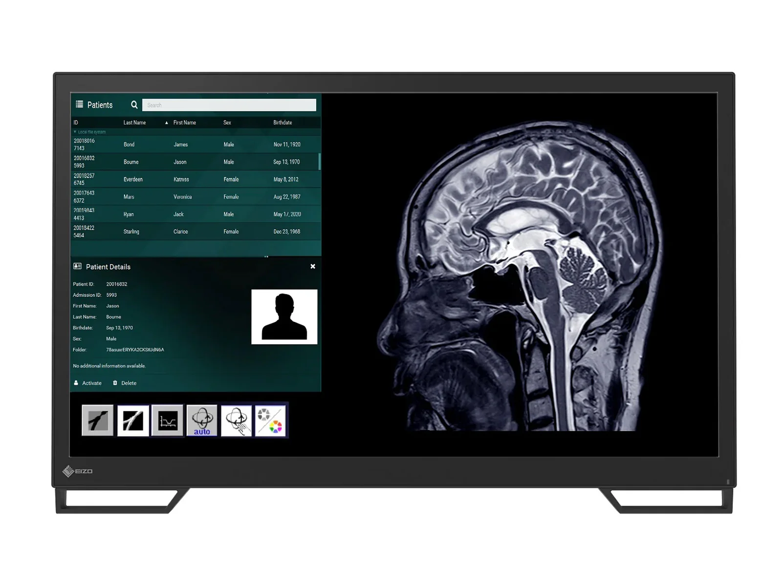 Eizo CuratOR LX2420-T 24" Surgical Touchscreen Monitor (LX2420-T)