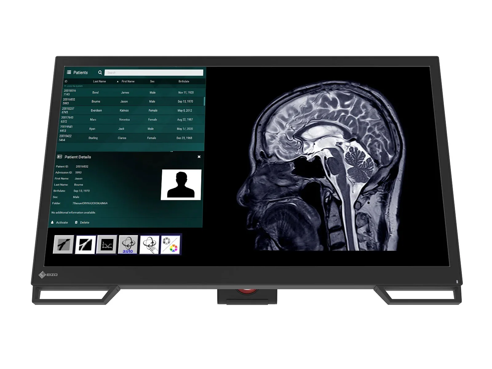 Eizo CuratOR LX2420-T 24" Surgical Touchscreen Monitor (LX2420-T) 2 Eizo CuratOR LX2420-T 24" Surgical Touchscreen Monitor (LX2420-T)