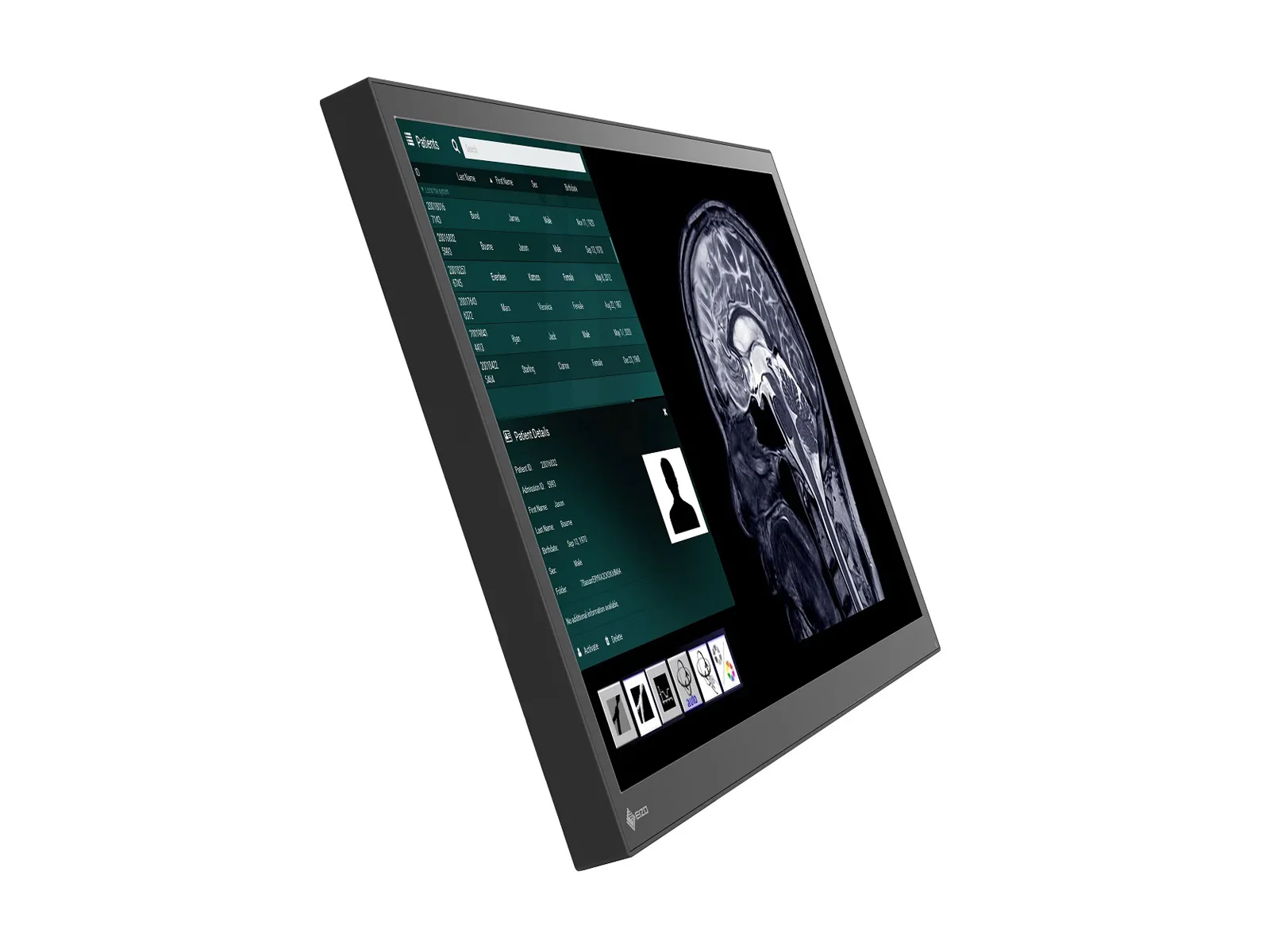 Eizo CuratOR LX2420-T 24" Surgical Touchscreen Monitor (LX2420-T) 3 Eizo CuratOR LX2420-T 24" Surgical Touchscreen Monitor (LX2420-T)
