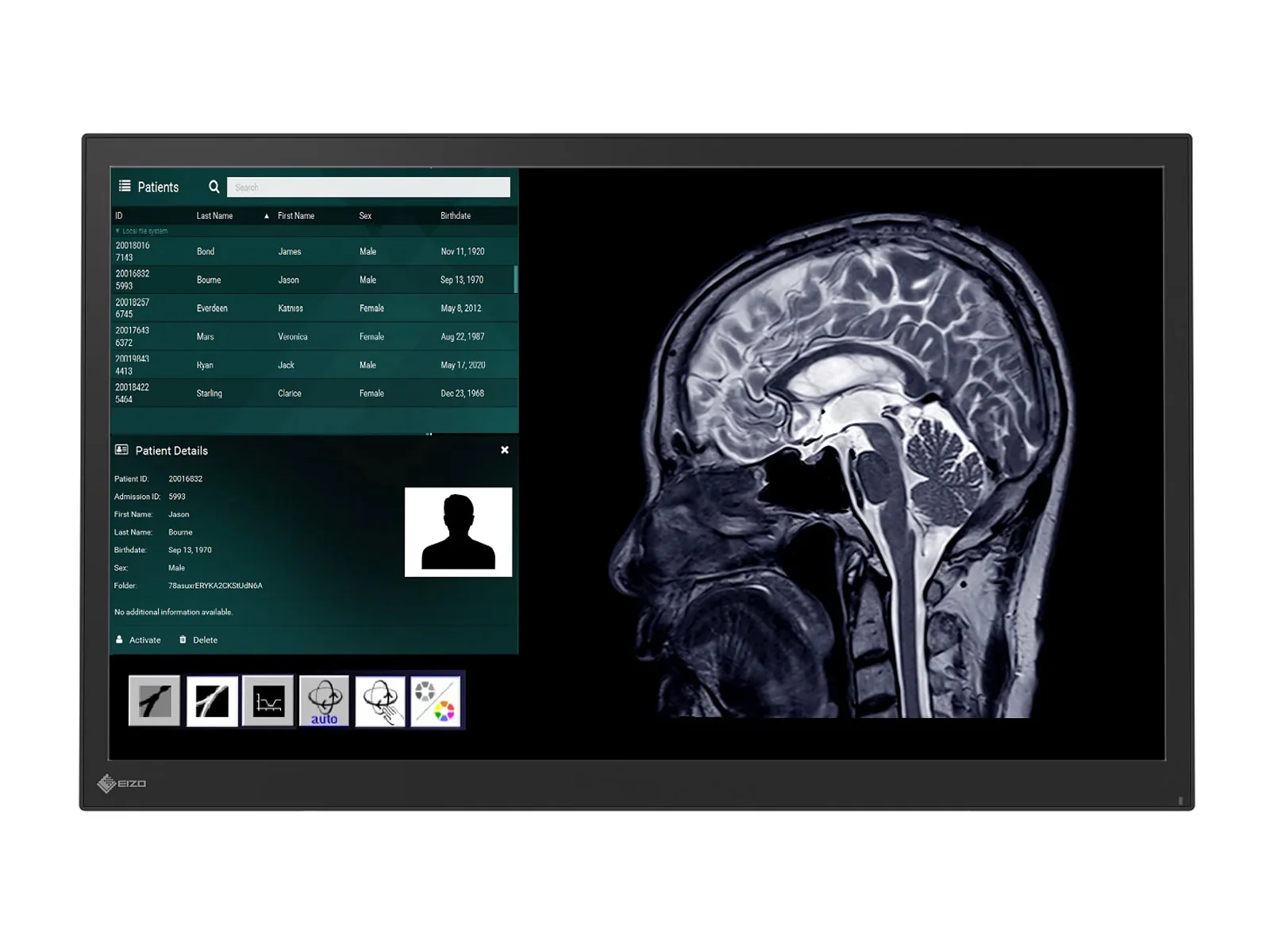 Eizo CuratOR LX2420-T 24" Surgical Touchscreen Monitor (LX2420-T) 4 Eizo CuratOR LX2420-T 24" Surgical Touchscreen Monitor (LX2420-T)