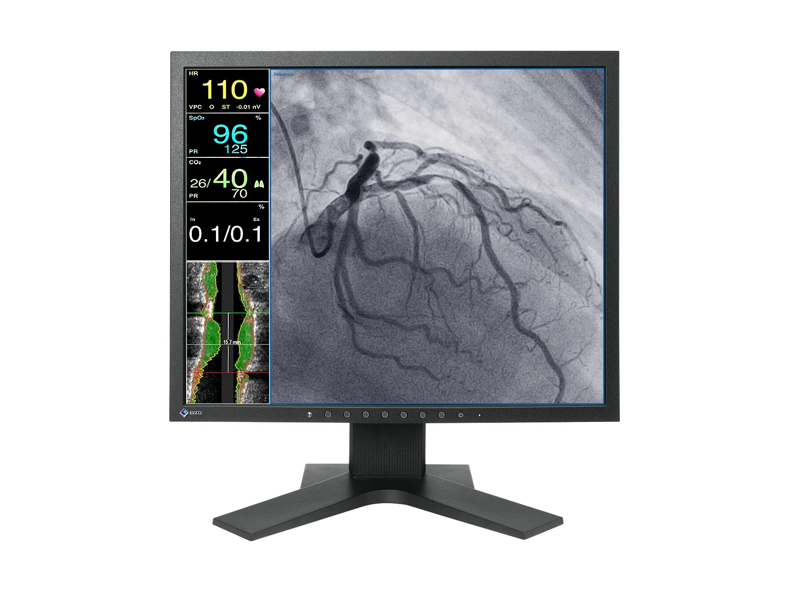 Eizo CuratOR 19" SXGA Surgical Endoscopy Medical LCD Display Monitor (LX1910-S)