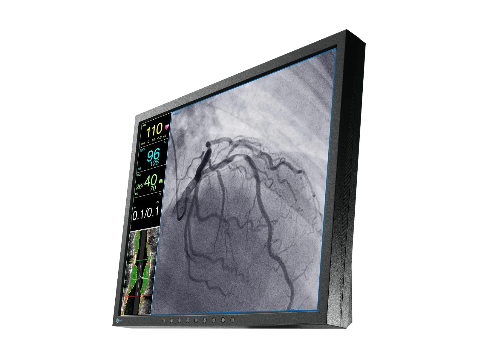 Eizo CuratOR 19" SXGA Surgical Endoscopy Medical LCD Display Monitor (LX1910-S) 2 Eizo CuratOR 19" SXGA Surgical Endoscopy Medical LCD Display Monitor (LX1910-S)