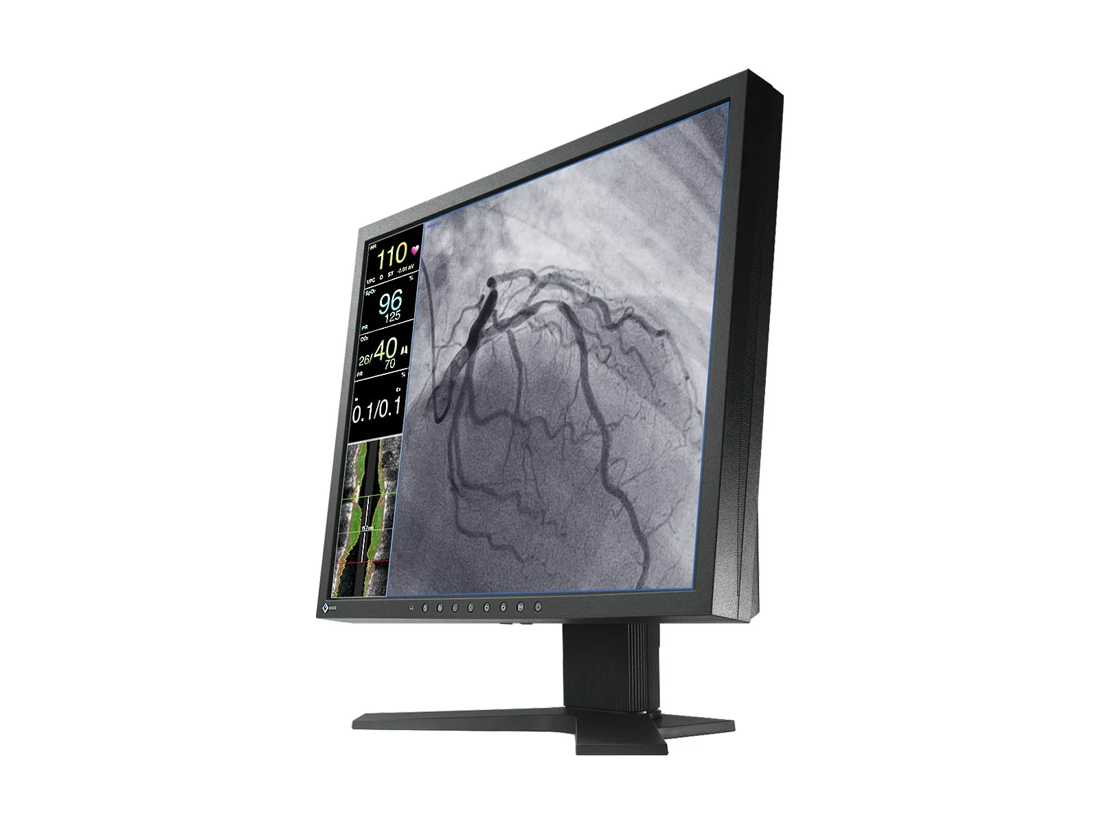Eizo CuratOR 19" SXGA Surgical Endoscopy Medical LCD Display Monitor (LX1910-S) 3 Eizo CuratOR 19" SXGA Surgical Endoscopy Medical LCD Display Monitor (LX1910-S)