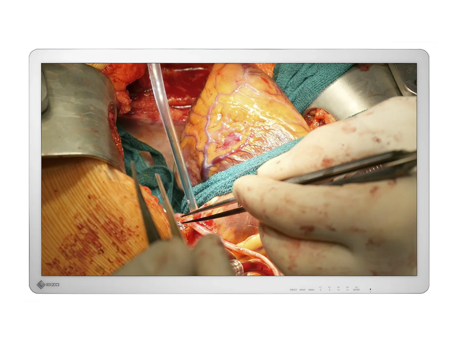 Eizo CuratOR 32" 4K UHD Surgical Endoscopy Medical Display Monitor (EX3242)