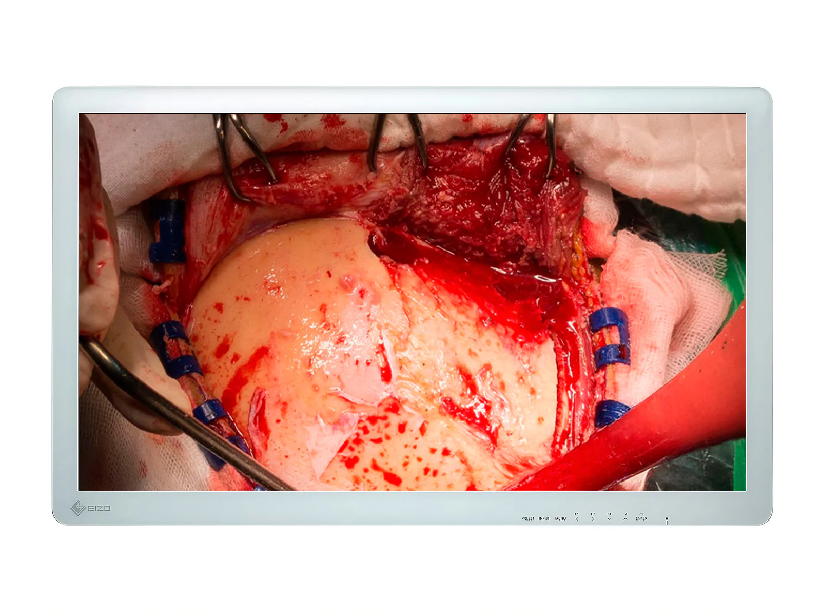 Eizo CuratOR 31.5" FHD Surgical Endoscopy Medical Display Monitor (EX3220)