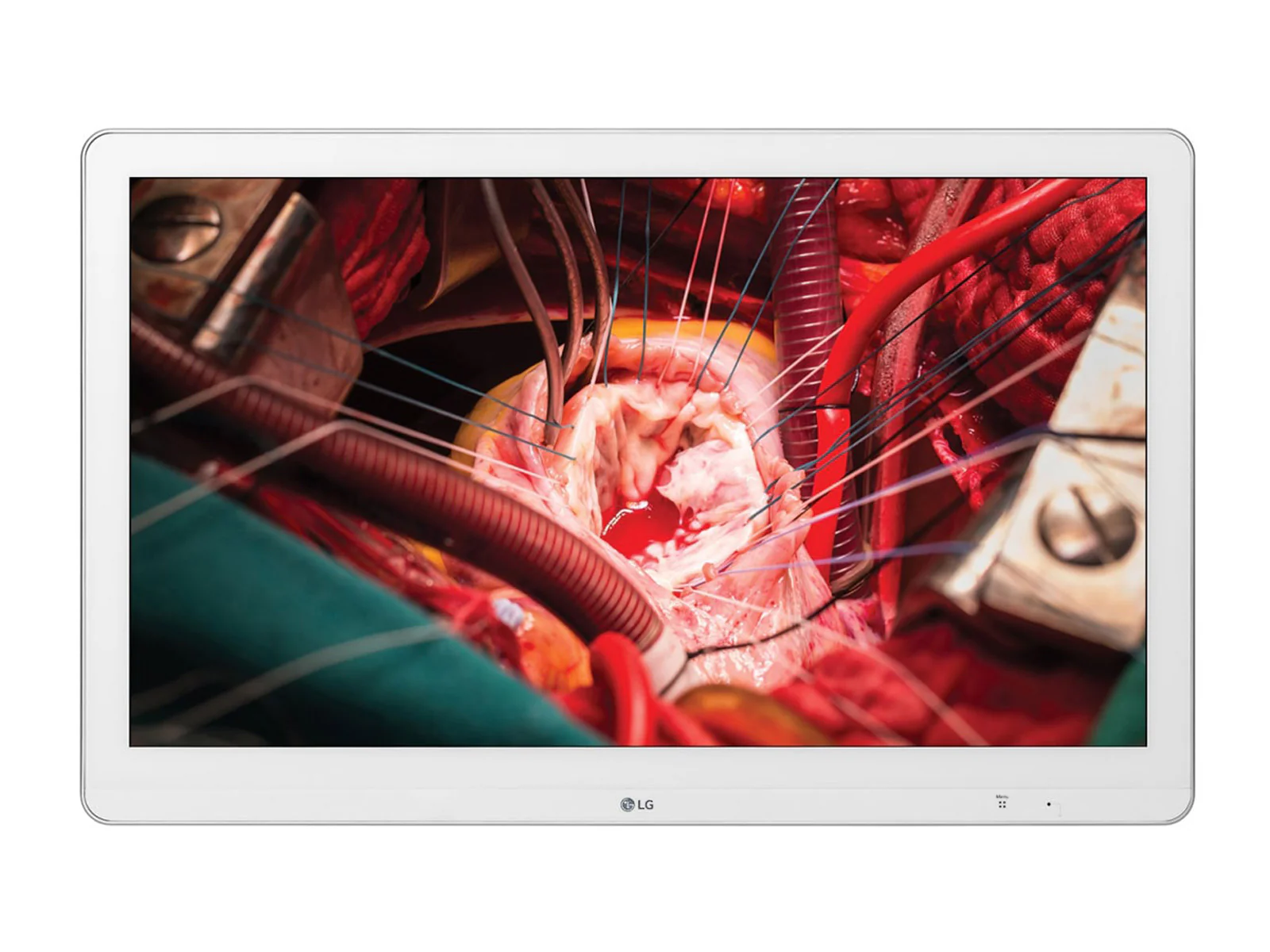 LG 27'' 27HK510S-W Full HD 2MP IPS 3G-SDI Surgical Endoscopy Medical Display Monitor 1 LG 27'' 27HK510S-W Full HD 2MP IPS 3G-SDI Surgical Endoscopy Medical Display Monitor