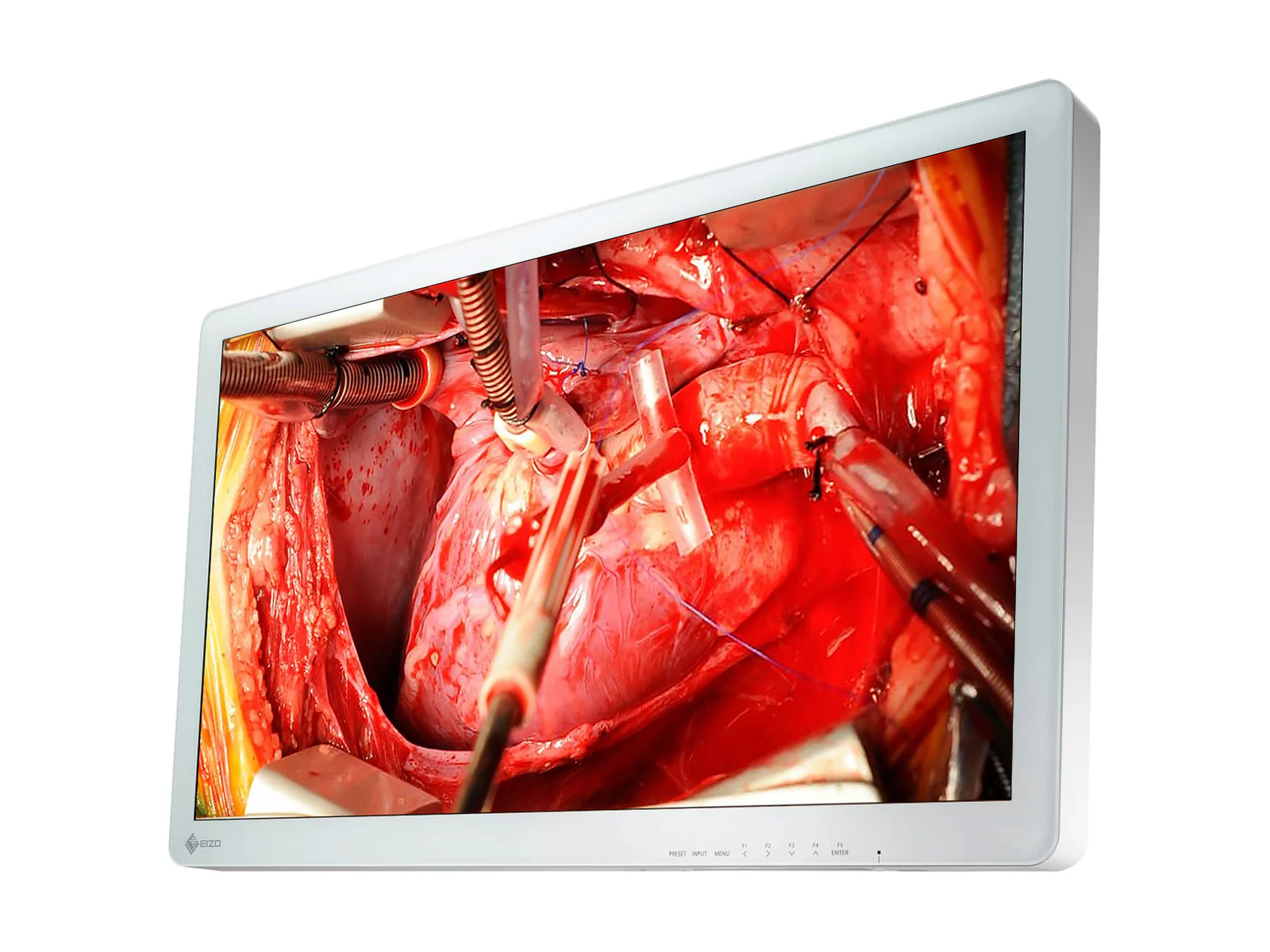 Eizo 26" FHD Surgical Endoscopy Medical LCD Display Monitor (EX2621) 2 Eizo 26" FHD Surgical Endoscopy Medical LCD Display Monitor (EX2621)