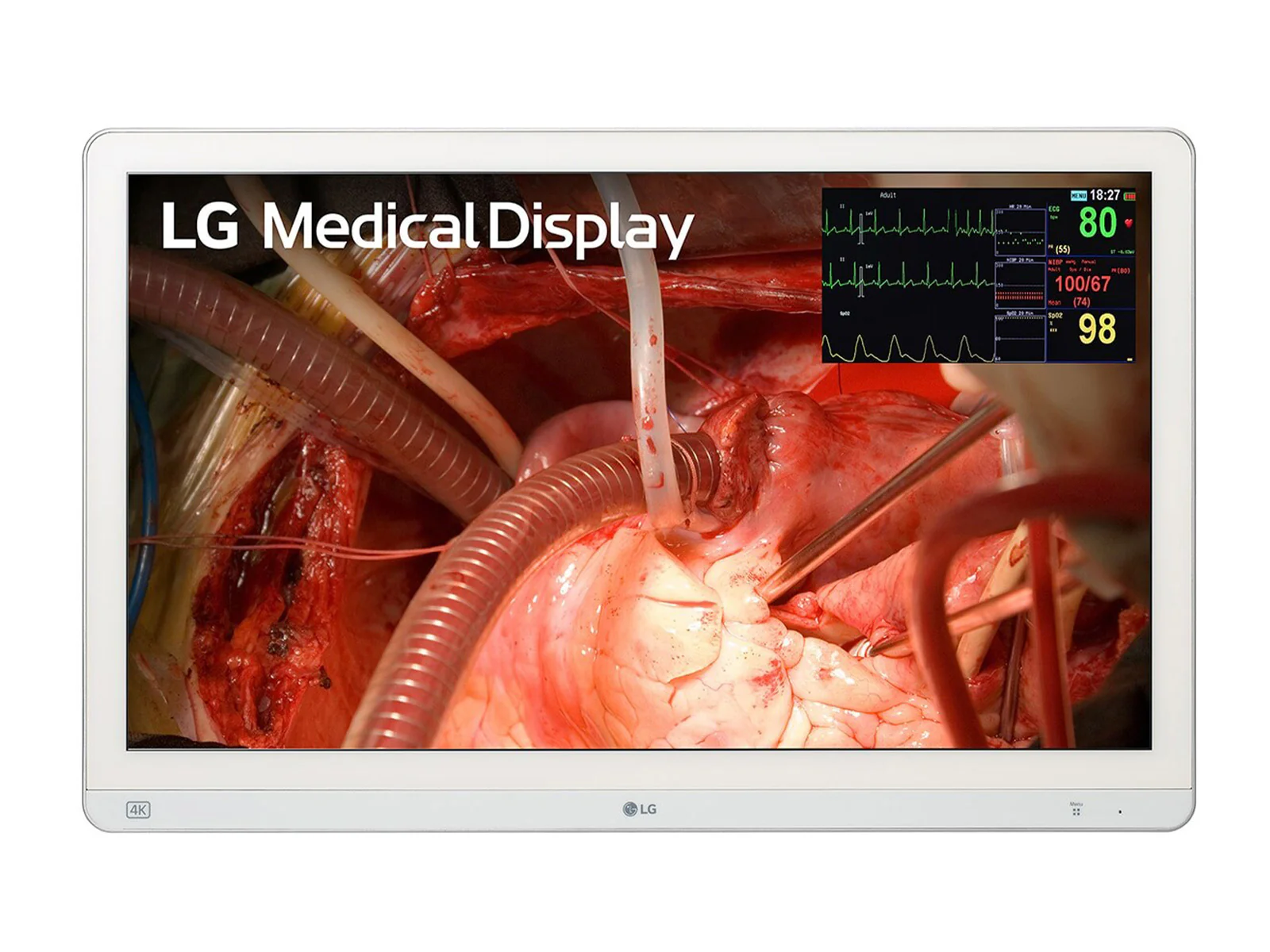LG 27" 27HQ710S-W 4K Mini-LED 3G SDI Surgical Endoscopy Medical Display Monitor 1 LG 27" 27HQ710S-W 4K Mini-LED 3G SDI Surgical Endoscopy Medical Display Monitor