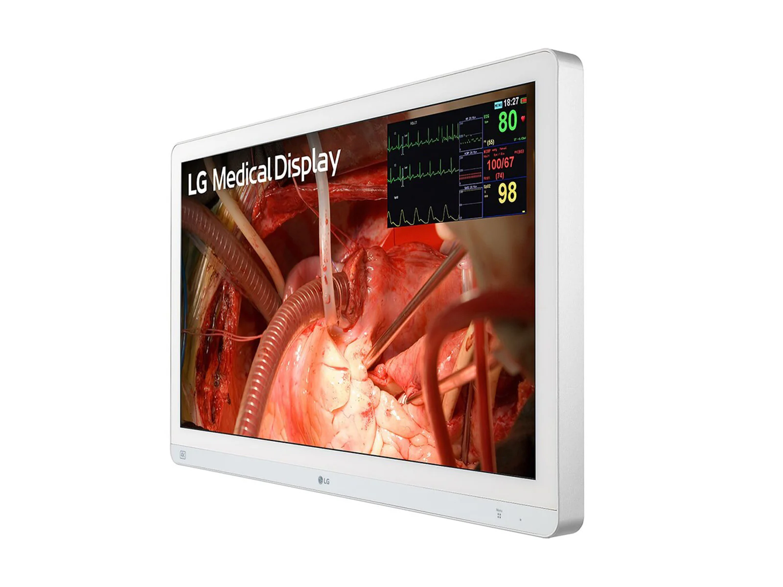 LG 27" 27HQ710S-W 4K Mini-LED 3G SDI Surgical Endoscopy Medical Display Monitor 2 LG 27" 27HQ710S-W 4K Mini-LED 3G SDI Surgical Endoscopy Medical Display Monitor