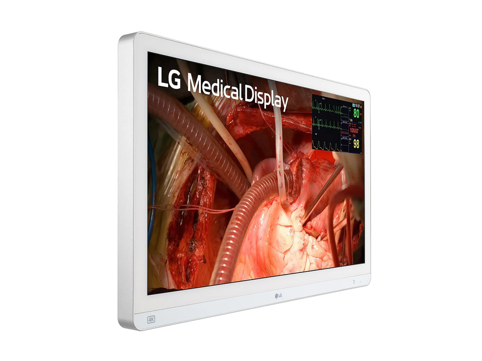 LG 27" 27HQ710S-W 4K Mini-LED 3G SDI Surgical Endoscopy Medical Display Monitor 3 LG 27" 27HQ710S-W 4K Mini-LED 3G SDI Surgical Endoscopy Medical Display Monitor