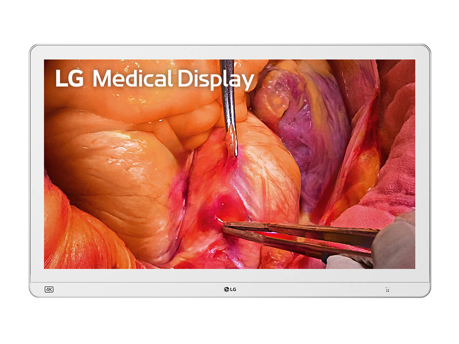 LG 27" 27HS714S-W 4K Mini-LED 12G SDI Surgical Endoscopy Medical Display Monitor 1 LG 27" 27HS714S-W 4K Mini-LED 12G SDI Surgical Endoscopy Medical Display Monitor