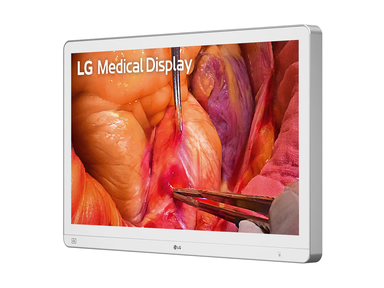 LG 27" 27HS714S-W 4K Mini-LED 12G SDI Surgical Endoscopy Medical Display Monitor 2 LG 27" 27HS714S-W 4K Mini-LED 12G SDI Surgical Endoscopy Medical Display Monitor