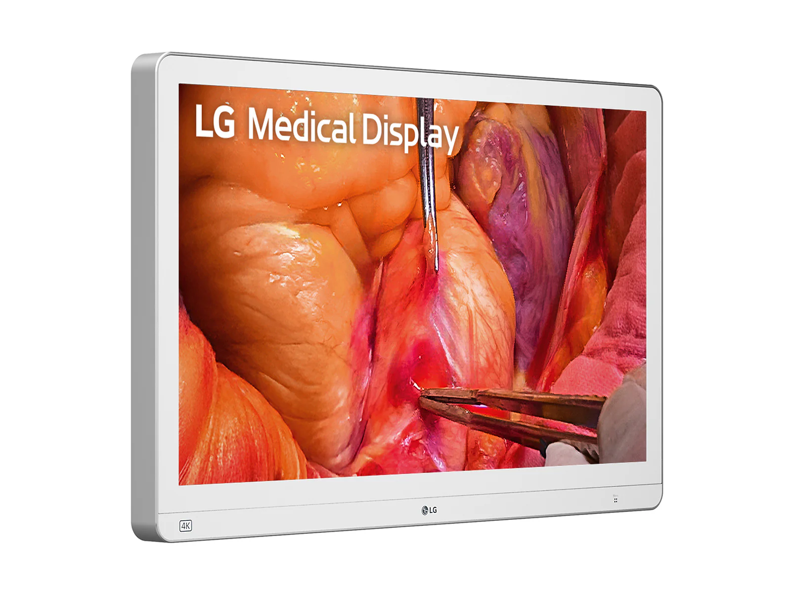 LG 27" 27HS714S-W 4K Mini-LED 12G SDI Surgical Endoscopy Medical Display Monitor 3 LG 27" 27HS714S-W 4K Mini-LED 12G SDI Surgical Endoscopy Medical Display Monitor