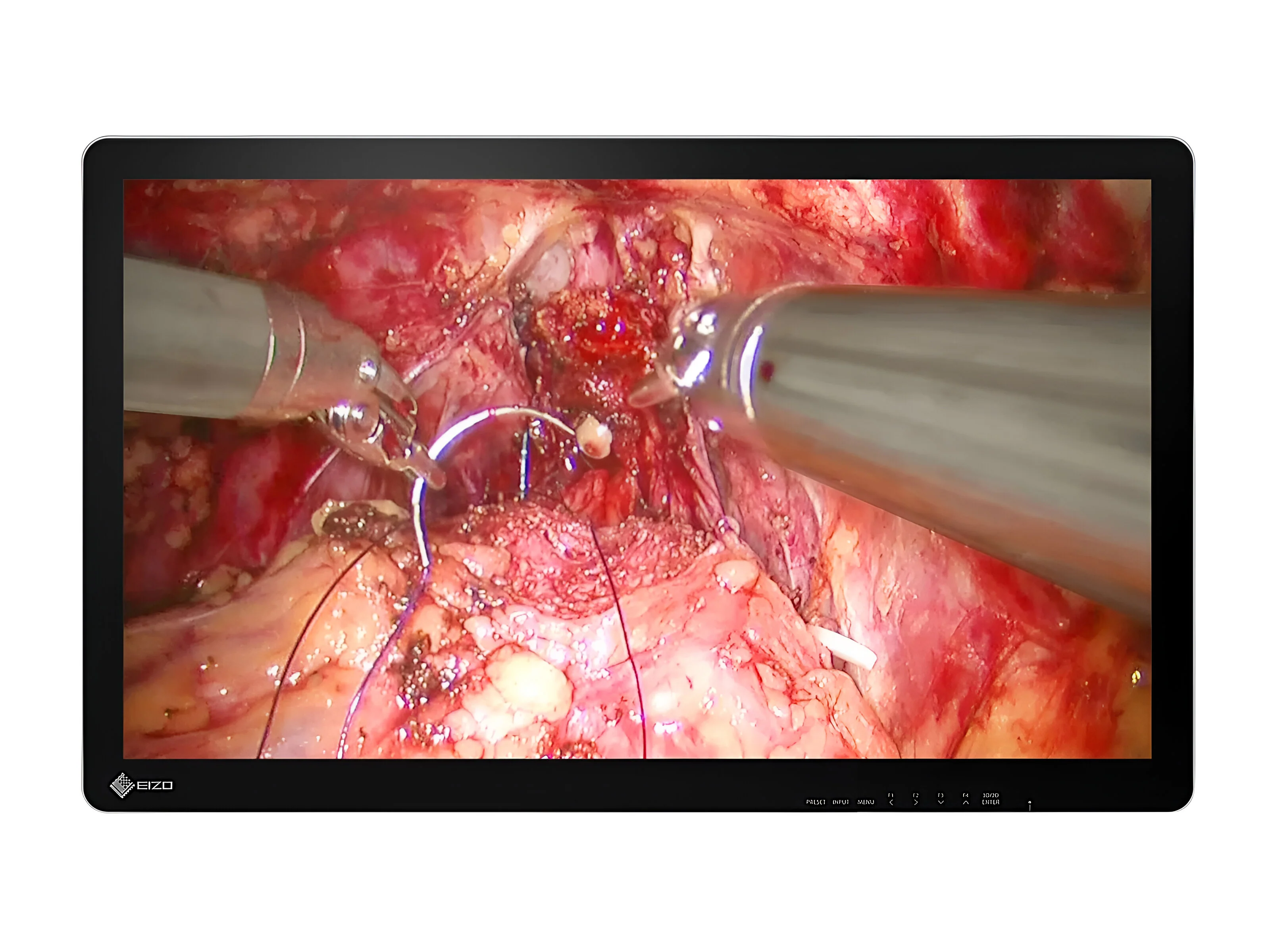 Eizo EX3242-3D 32" 4K 3D IPS Surgical Endoscopy Medical Display Monitor (EX3242-3D)