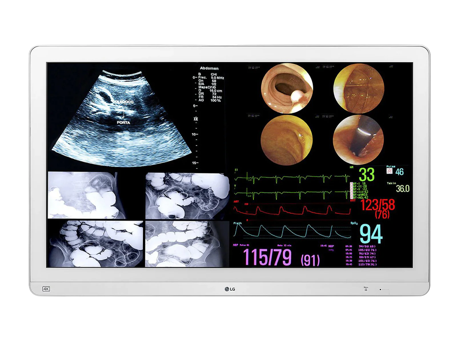 LG 31.5" LED 4K IPS 12G SDI Surgical Endoscopy Display Monitor (32HL714S-W) 1 LG 31.5" LED 4K IPS 12G SDI Surgical Endoscopy Display Monitor (32HL714S-W)
