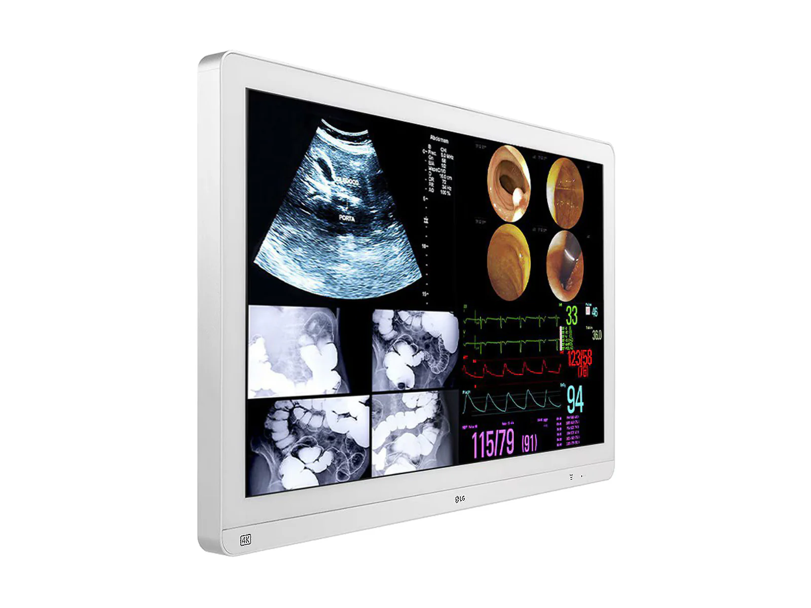 LG 31.5" LED 4K IPS 12G SDI Surgical Endoscopy Display Monitor (32HL714S-W) 2 LG 31.5" LED 4K IPS 12G SDI Surgical Endoscopy Display Monitor (32HL714S-W)