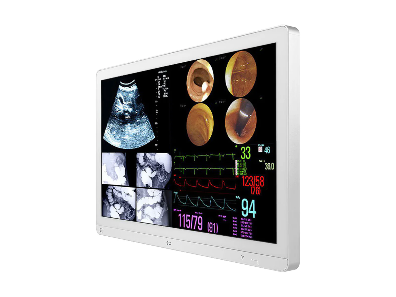 LG 31.5" LED 4K IPS 12G SDI Surgical Endoscopy Display Monitor (32HL714S-W) 3 LG 31.5" LED 4K IPS 12G SDI Surgical Endoscopy Display Monitor (32HL714S-W)