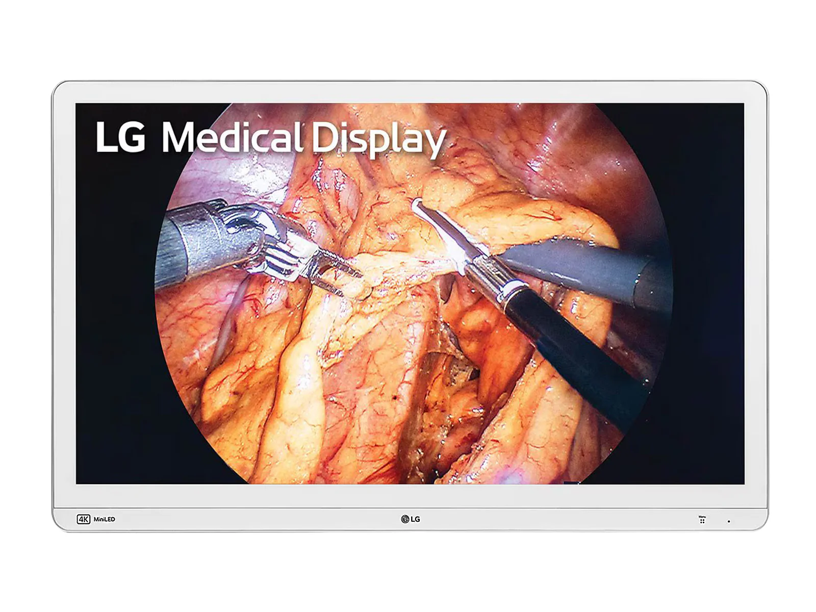 LG Mini-LED 31.5" 32HR734S-W 8MP 4K UHD 12G SDI Surgical Endoscopy Medical Display Monitor 1 LG Mini-LED 31.5" 32HR734S-W 8MP 4K UHD 12G SDI Surgical Endoscopy Medical Display Monitor