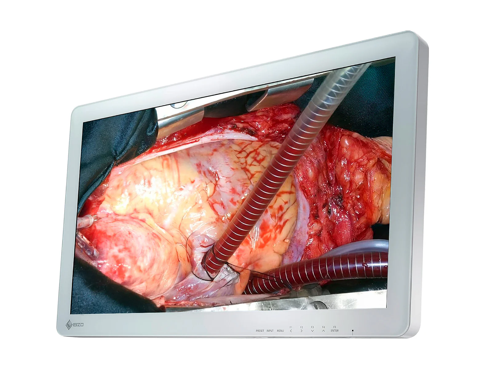 Eizo EX2620 LED 26" FHD Surgical LCD Monitor (EX2620) 2 Eizo EX2620 LED 26" FHD Surgical LCD Monitor (EX2620)