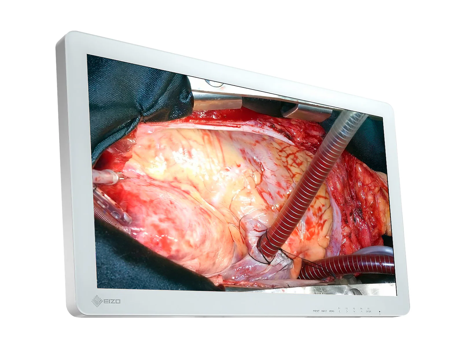 Eizo EX2620 LED 26" FHD Surgical LCD Monitor (EX2620) 3 Eizo EX2620 LED 26" FHD Surgical LCD Monitor (EX2620)