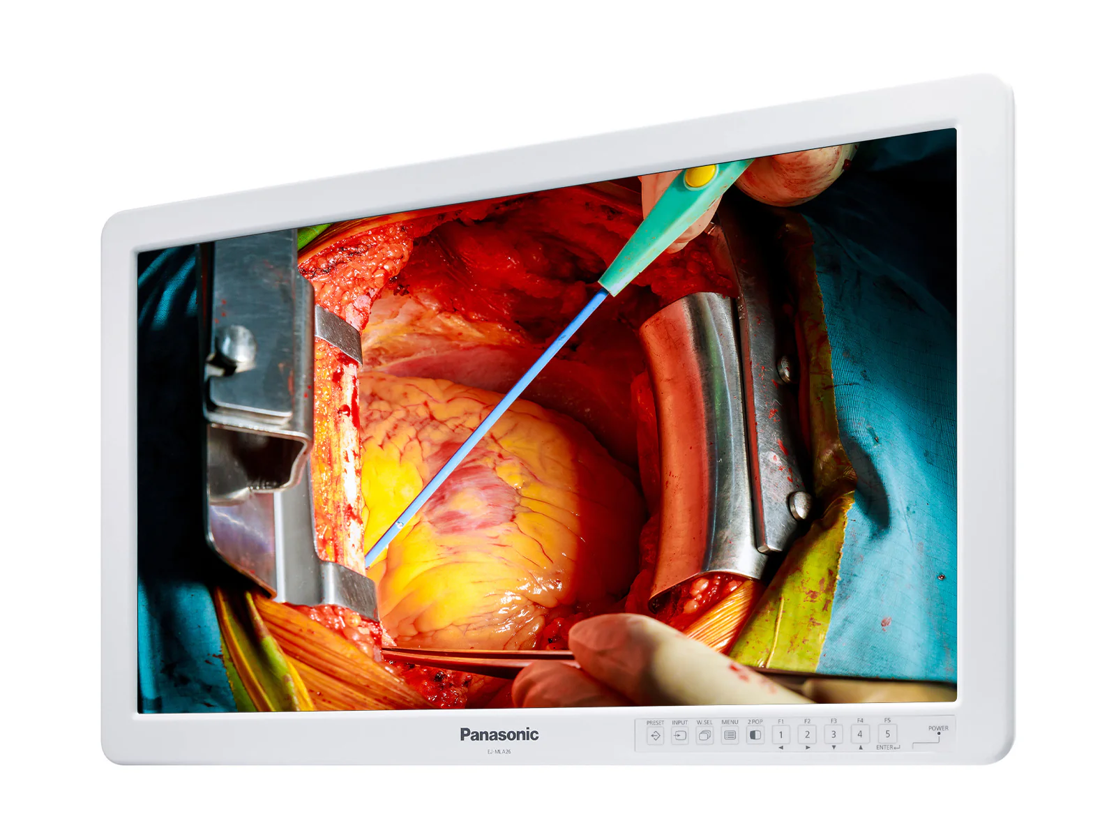 Panasonic EJ-MLA26U 26” 8MP WUXGA Surgical Medical Display Monitor (EJ-MLA26U) 1 Panasonic EJ-MLA26U 26” 8MP WUXGA Surgical Medical Display Monitor (EJ-MLA26U)