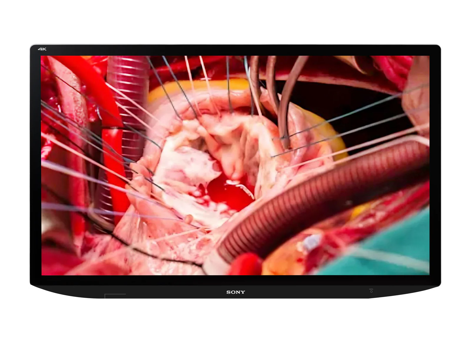Sony LMD-X310MT 31" LCD 4K 3D/2D Surgical Medical Display Monitor (LMD-X310MT)