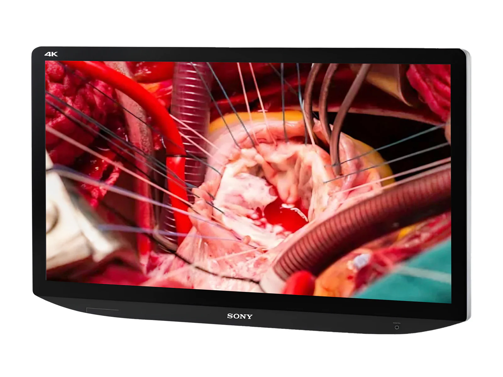 Sony LMD-X310MT 31" LCD 4K 3D/2D Surgical Medical Display Monitor (LMD-X310MT) 2 Sony LMD-X310MT 31" LCD 4K 3D/2D Surgical Medical Display Monitor (LMD-X310MT)